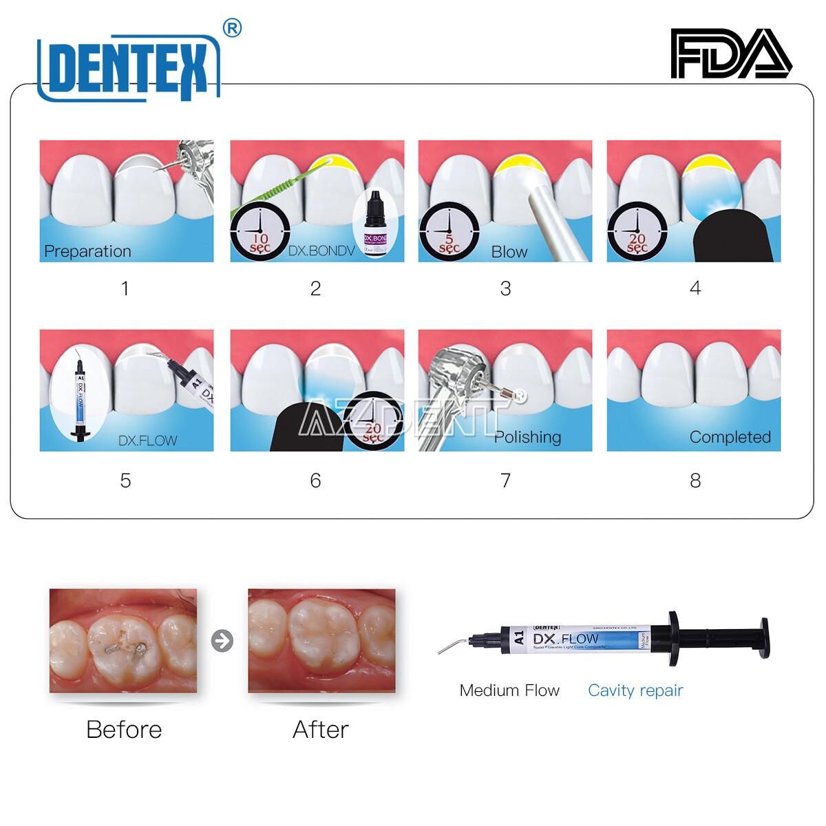 USA DX.Flow Dental Composite Resin A1 A2 A3 Flowable Light Cure Medium Flow