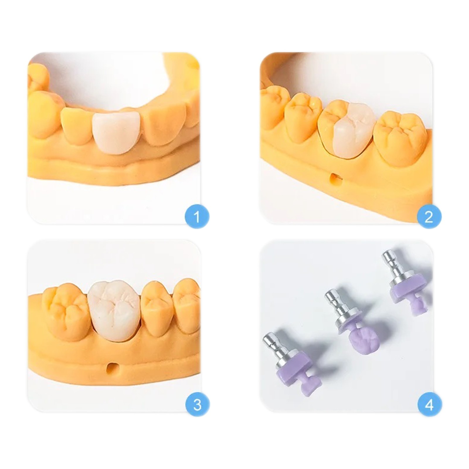 US C14 Dental IPS Emax CAD Lithium-Disilicate Milling Blocks LT For CEREC 5/Box