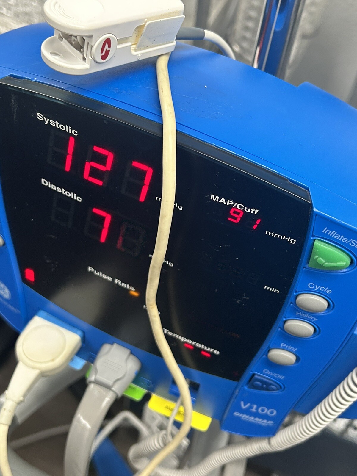 Dinamap Carescape V100 NIBP Masimo SpO2 Temp On Rolling Stand Patient Ready