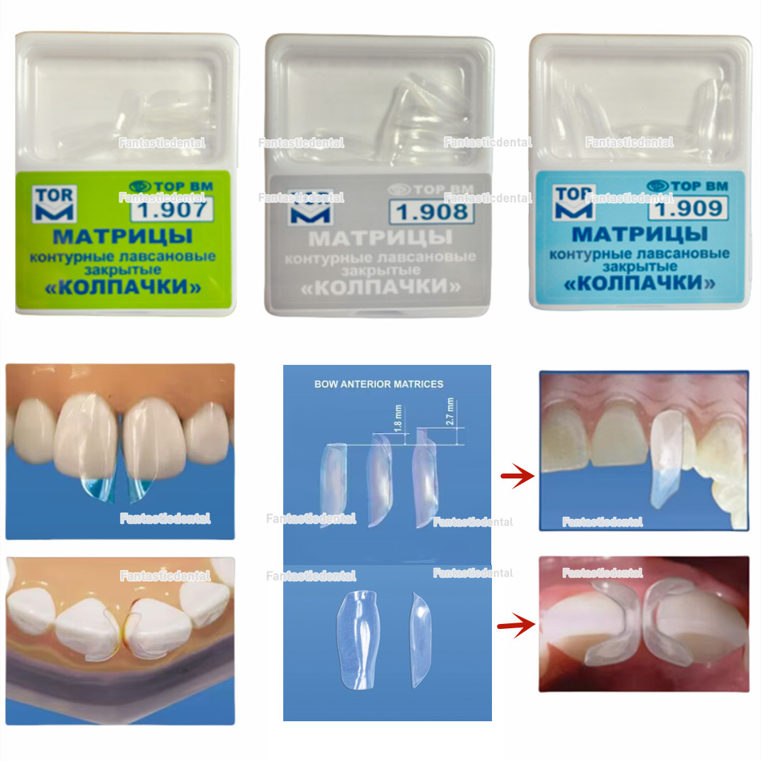 Dental Clear Matrix TOR VM Matrice Anterior Matrices BT Fit Bioclear L/M/S 10Pcs