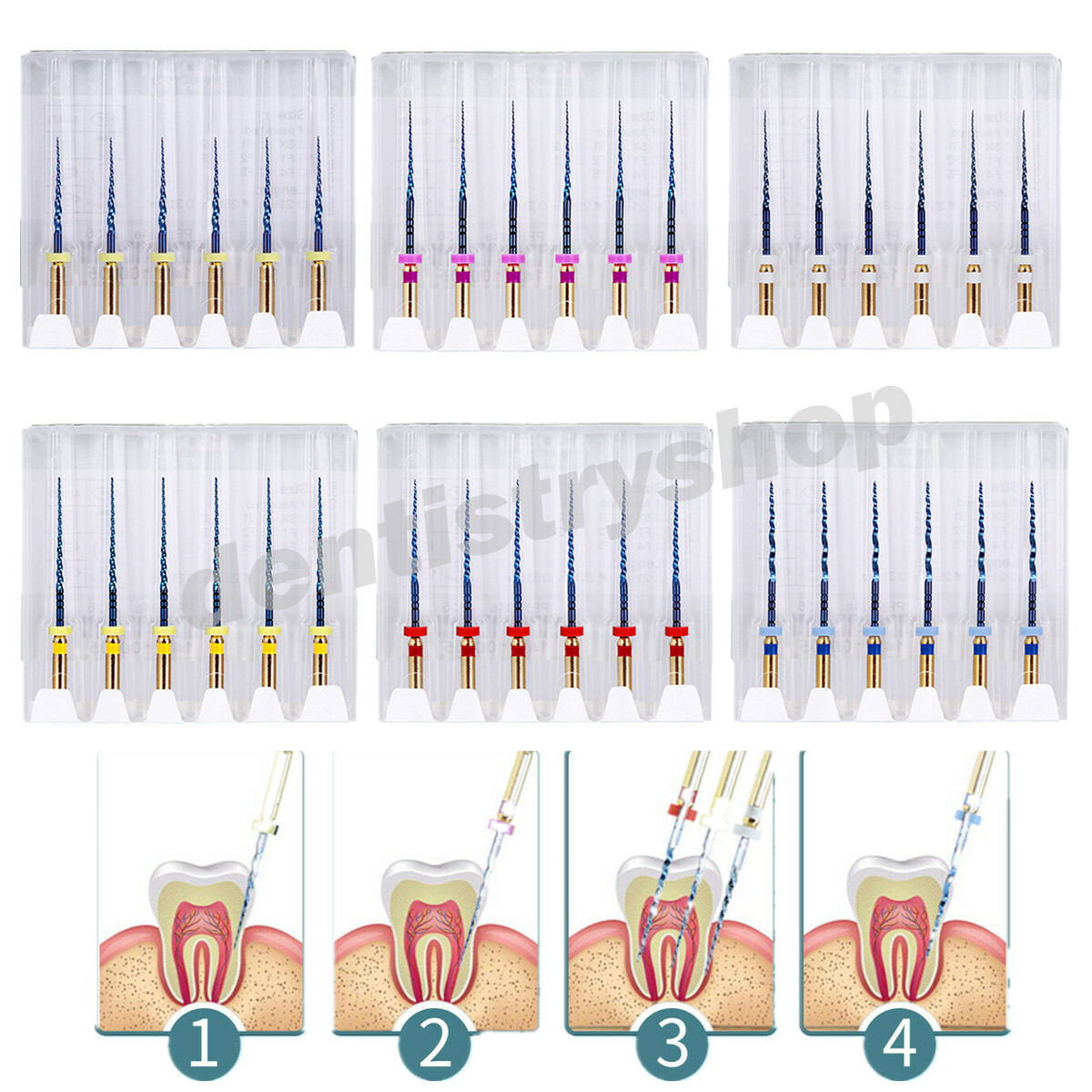 AZDENT Dental Endo Rotary Files X-Pro Gold Taper SX-F3 NITI Root Canal Files