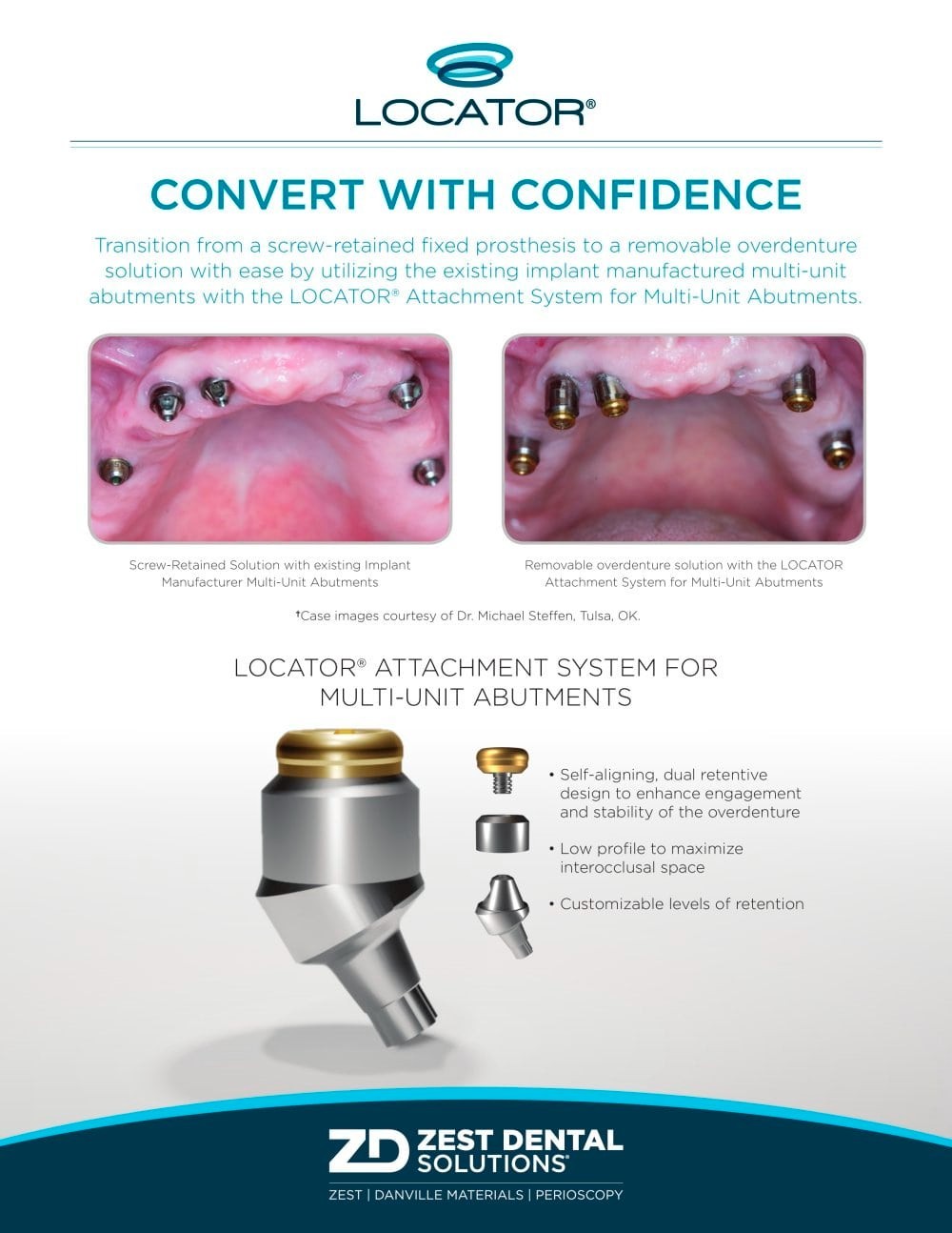Angled Overdenture Abutment Multi-Unit Ø4.8mm Fit Osstem Hiossen Nobel Active