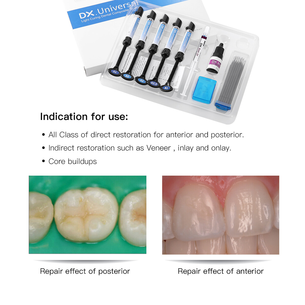Dental Light Cure Universal Composite Resin / Composite Resin Heater 40/45/50℃