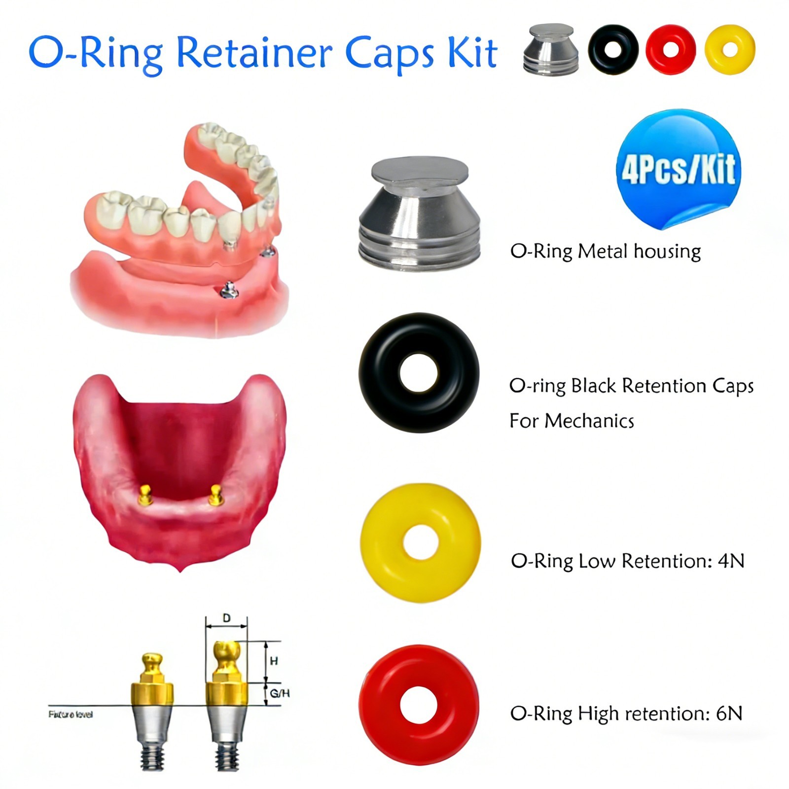US Dental O-ring Retainer Caps Kit For Implant Osstem Ball Attachment Abutments