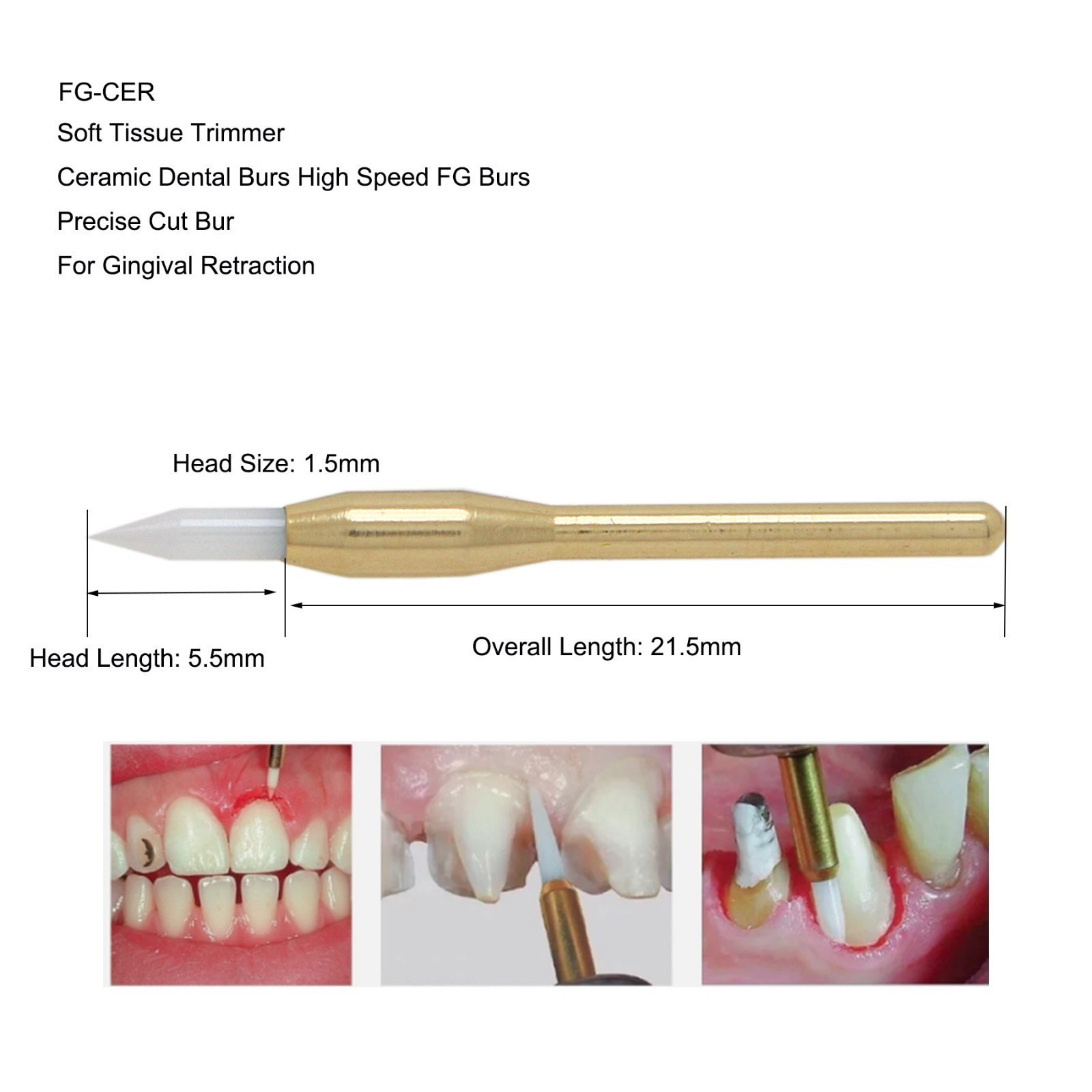 Dental Surgical Ceramic Soft Tissue Trimmer Bur for Gingivectomy – FG