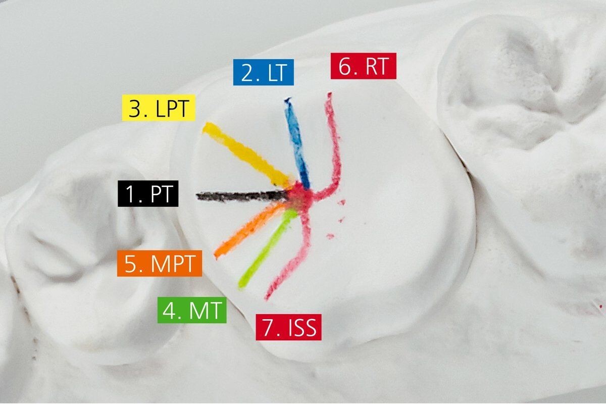 Dental Lab Renfert Geo Expert Functional Wax set modeling crown bridges