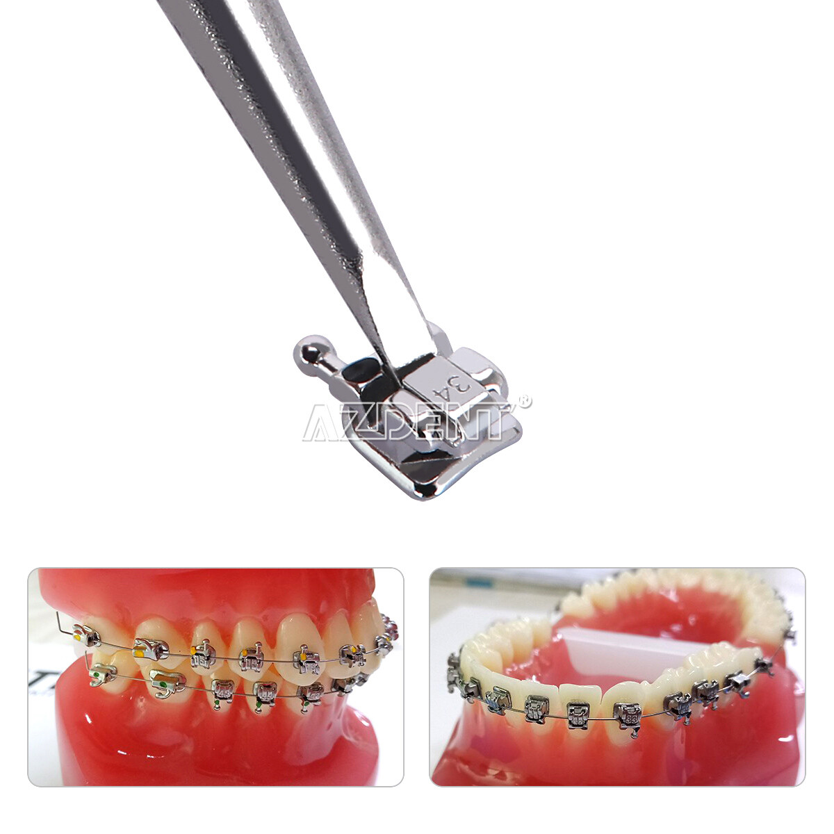 AZDENT Dental Orthodontic MIM Self Ligating Bracket Braces with Buccal Tubes