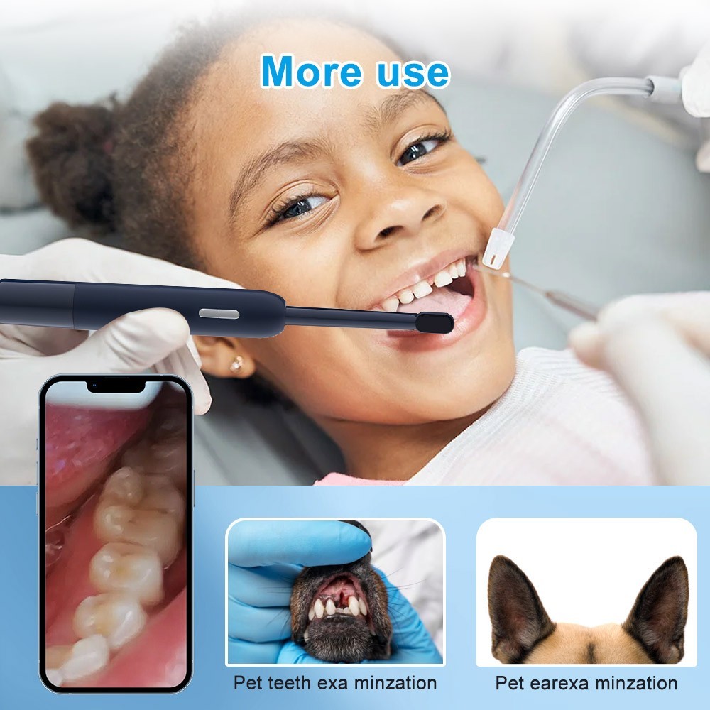 5MP Visual Intraoral Camera WIFI Oral Examination Camera IP67 Waterproof 1920P