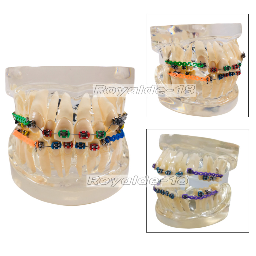 DAMON 30Packs Dental Orthodontic Arch Wires Stop Copper Cu-Niti Study Model Wire