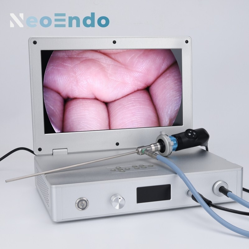 HD Portable Medical Endoscope Camera With 15.6 Inch Monitor 80W Light Source