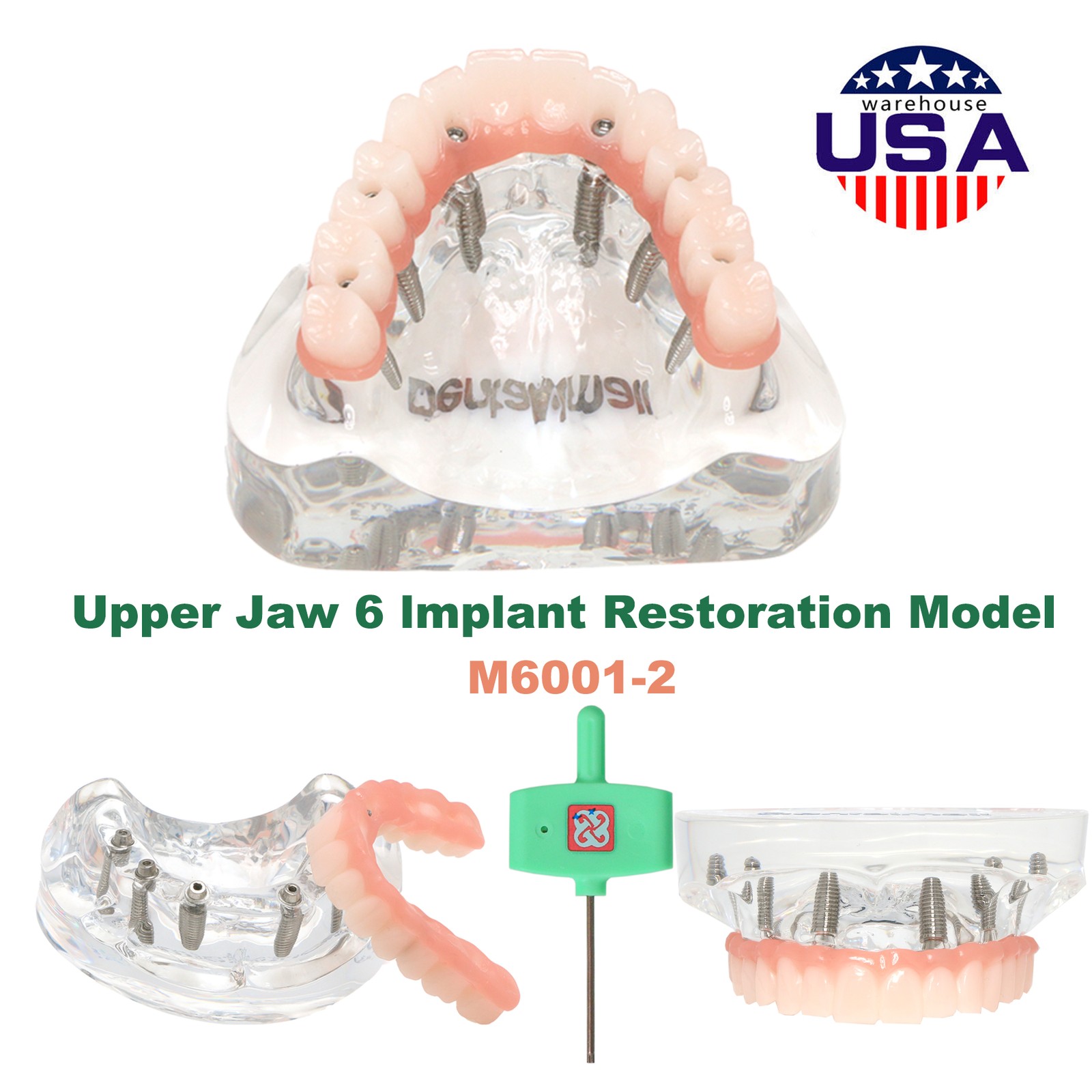 US Dental Overdenture/Implant/Orthodontic Typodont Ortho Training Teaching Model