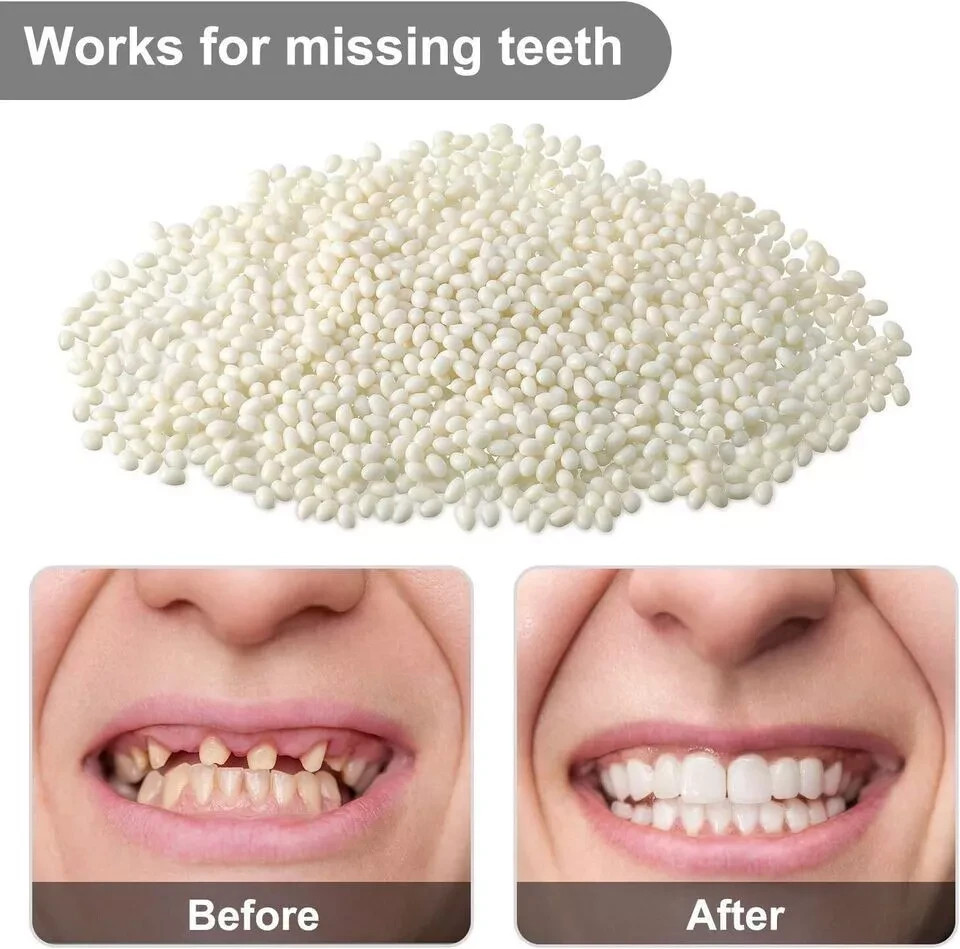 25g/Box Dental Temporary Replacement Filling Material Repair Denture False Tooth