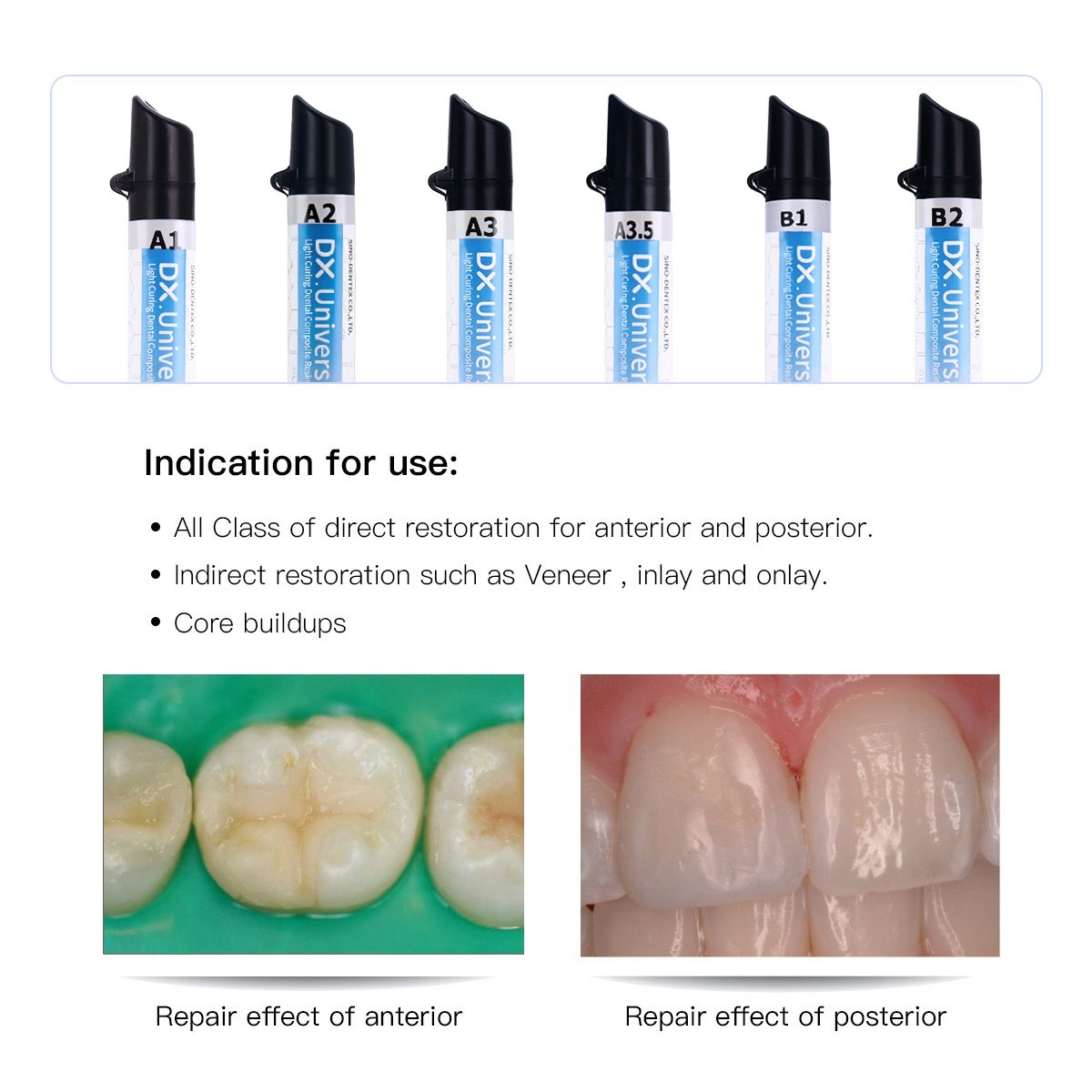 Dental Universal Light Cure Composite Resin/Etching Gel/Bonding Adhesive