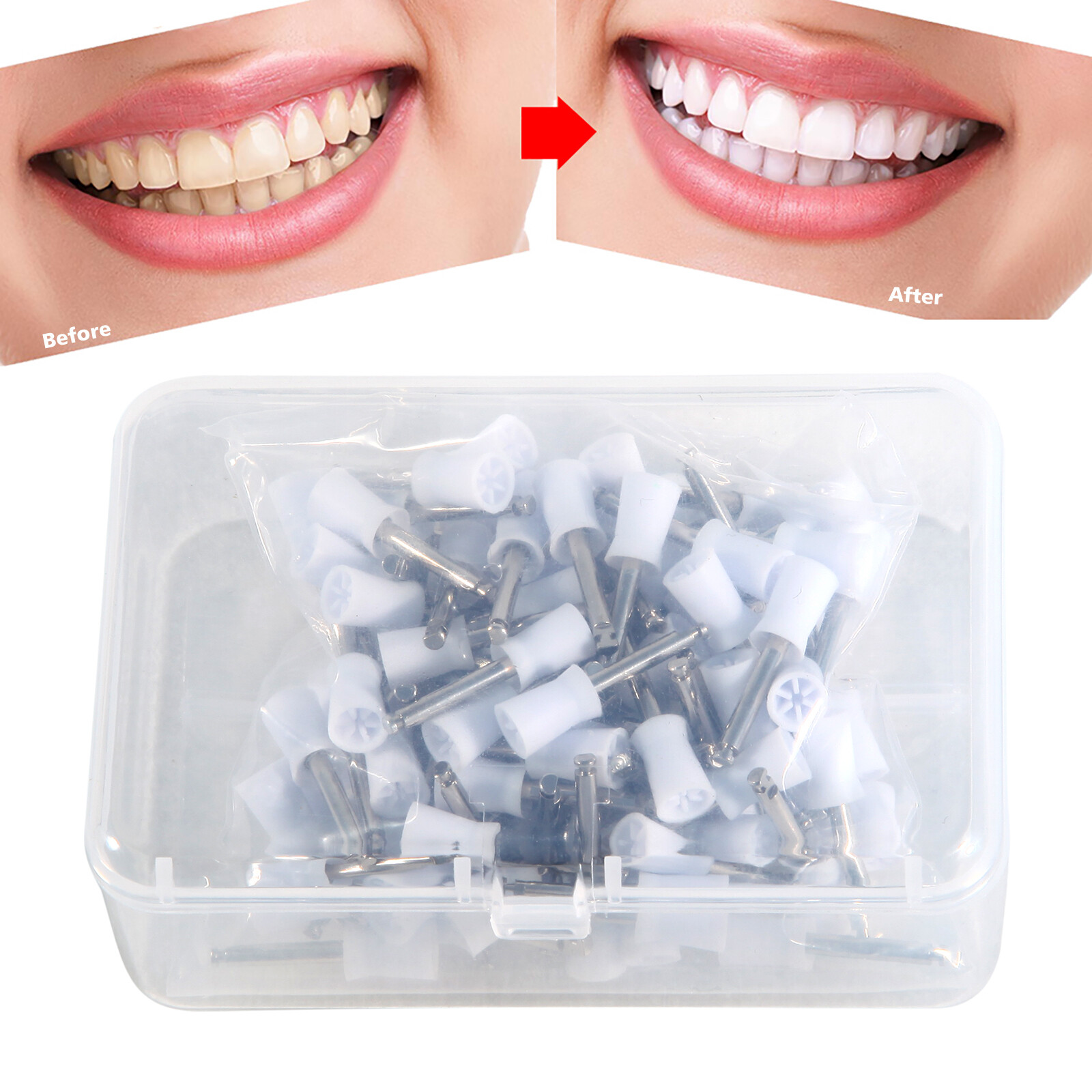 100pcs/box Dental Polishing Polish Cups Prophy Cup Latch Type Brush Rubber white