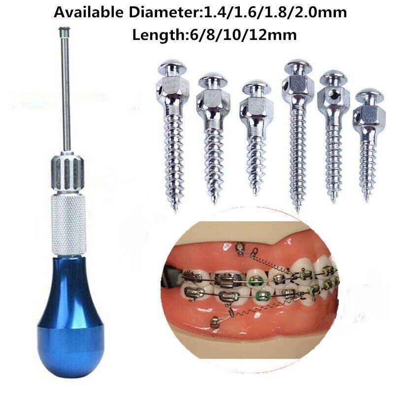 Dental Orthodontic Micro Implants Mini Screw Self-Drilling 1.4/1.6/1.8/2.0mm