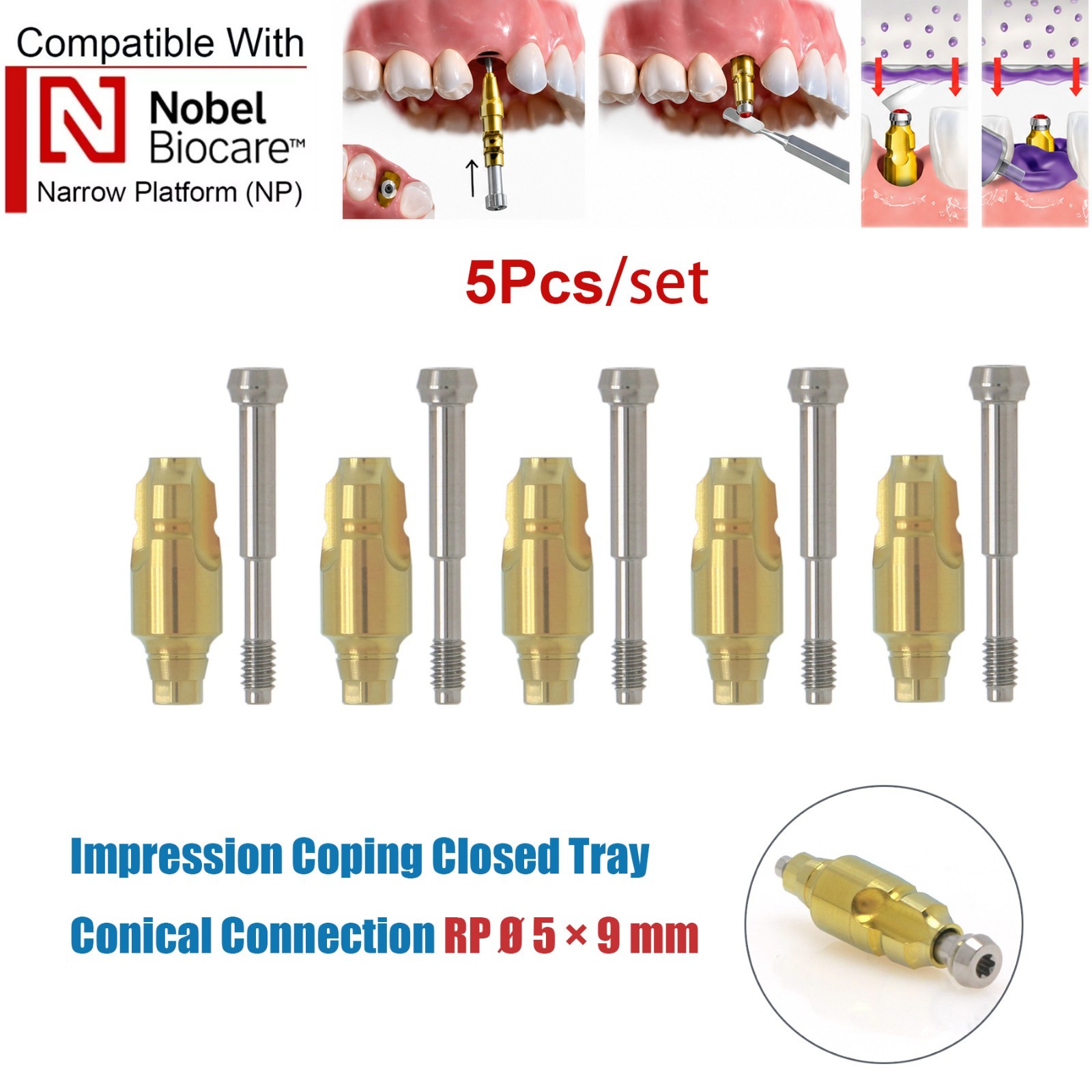 US 5Pcs Nobel Scan Body Analog Open Closed Tray Impression Transfer Conical Hex