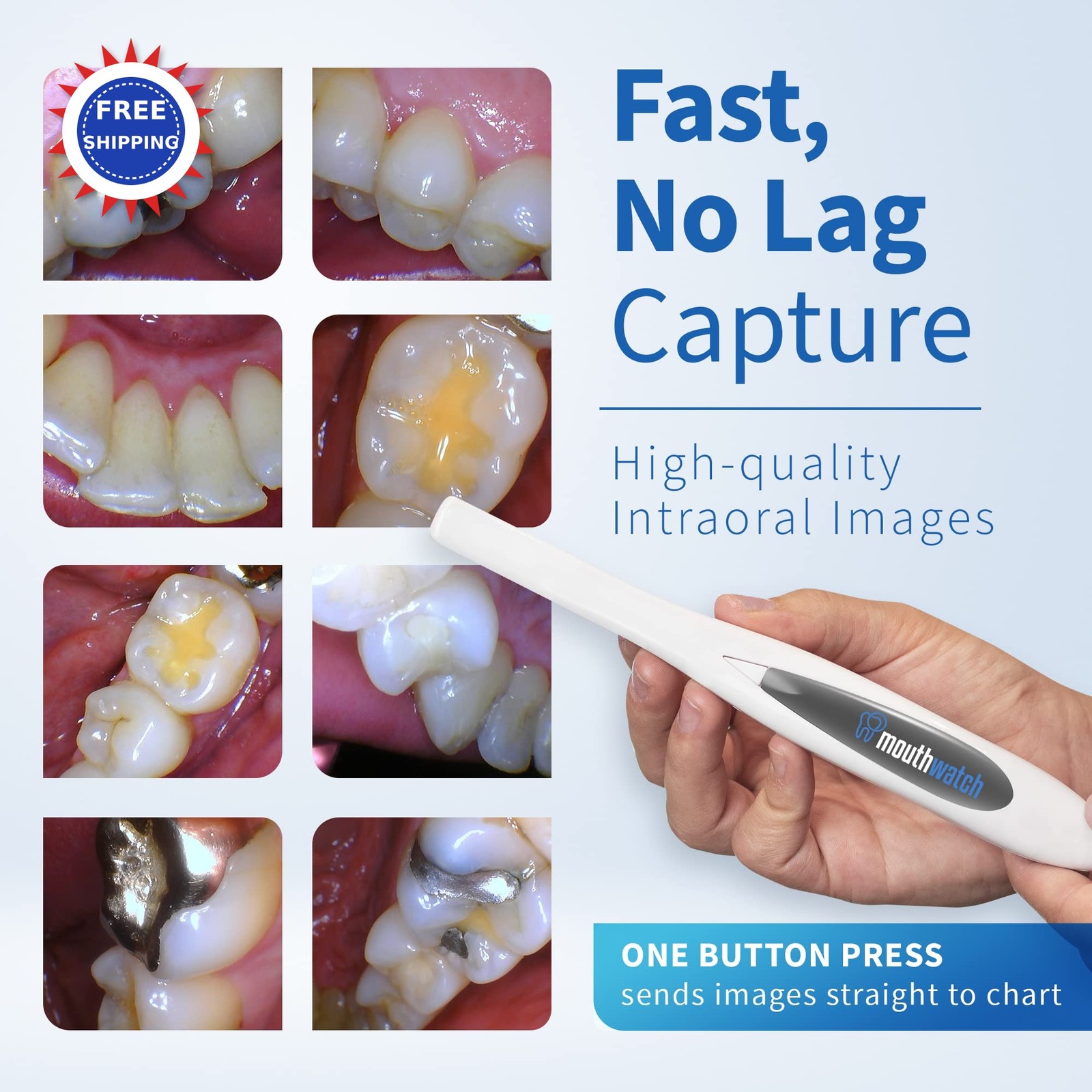 Intraoral Camera MouthWatch Crystal Clear Images Dental Lightweight 31G Easy