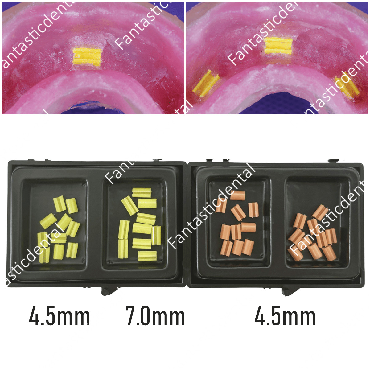 Dental Clips Retention Overdenture Rider Hader Bar Attachment Short 4.5mm Long 7