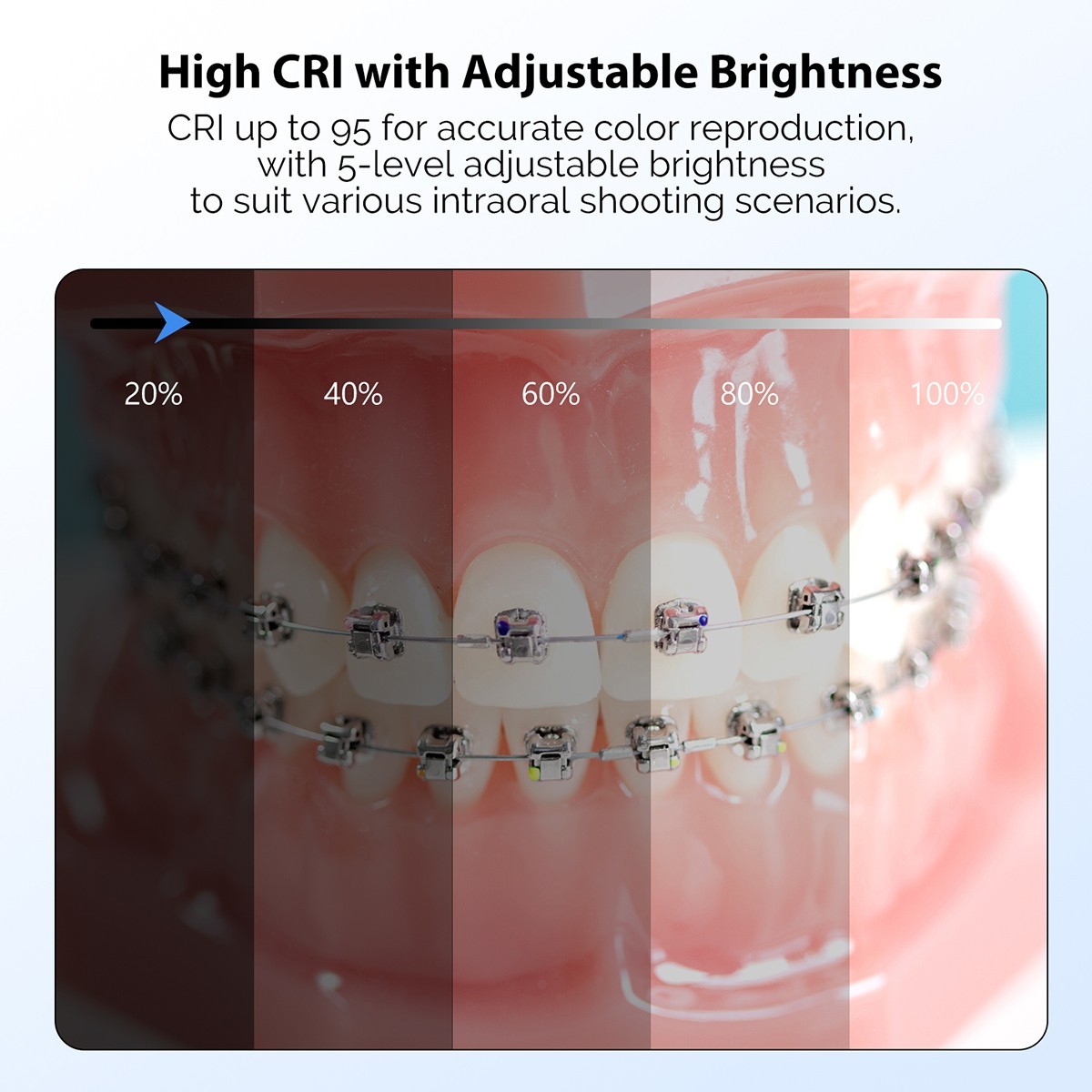 Handheld Dental Intraoral Photography Light Oral Photo Video LED Filling Light