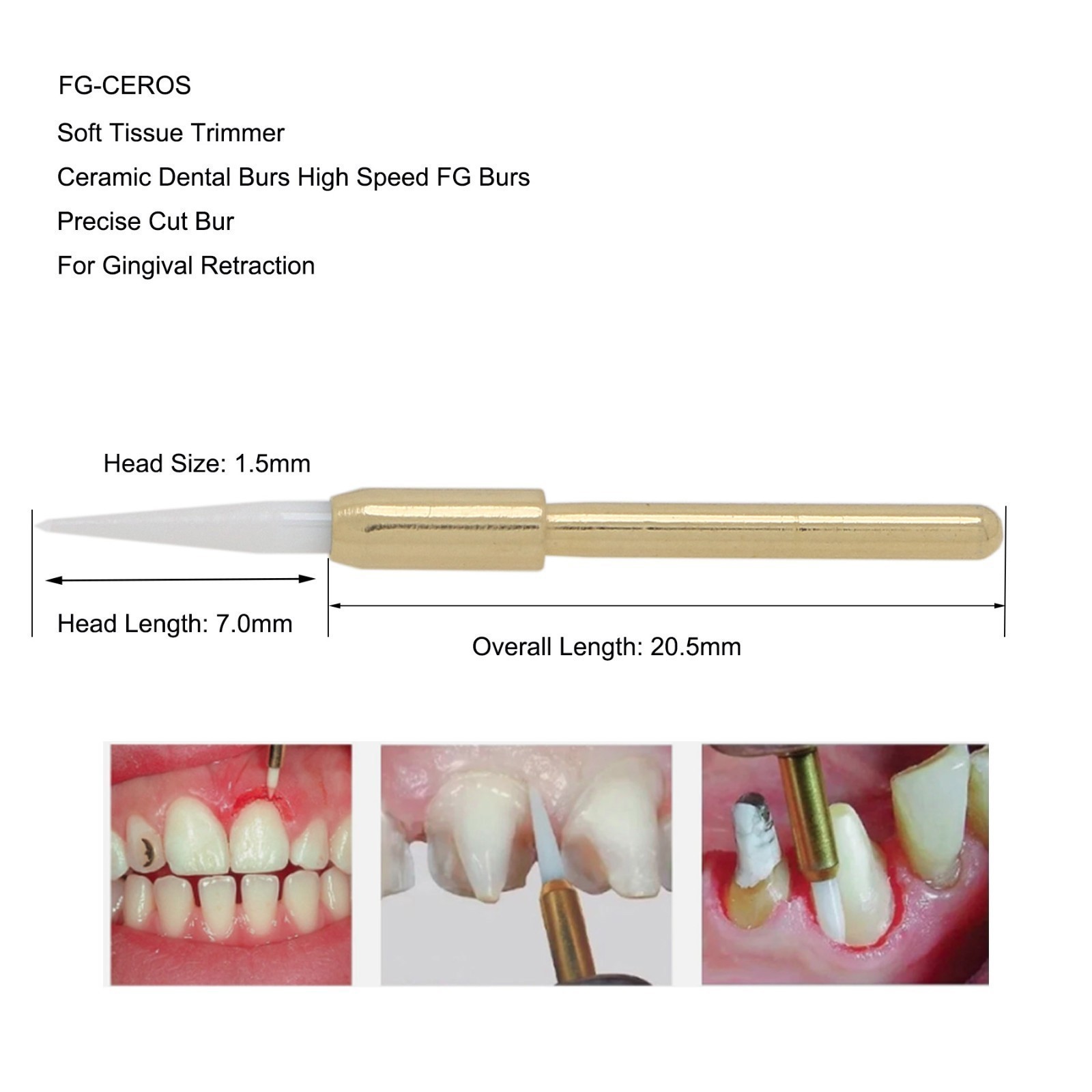 Dental Surgical Ceramic Soft Tissue Trimmer Bur for Gingivectomy – FG