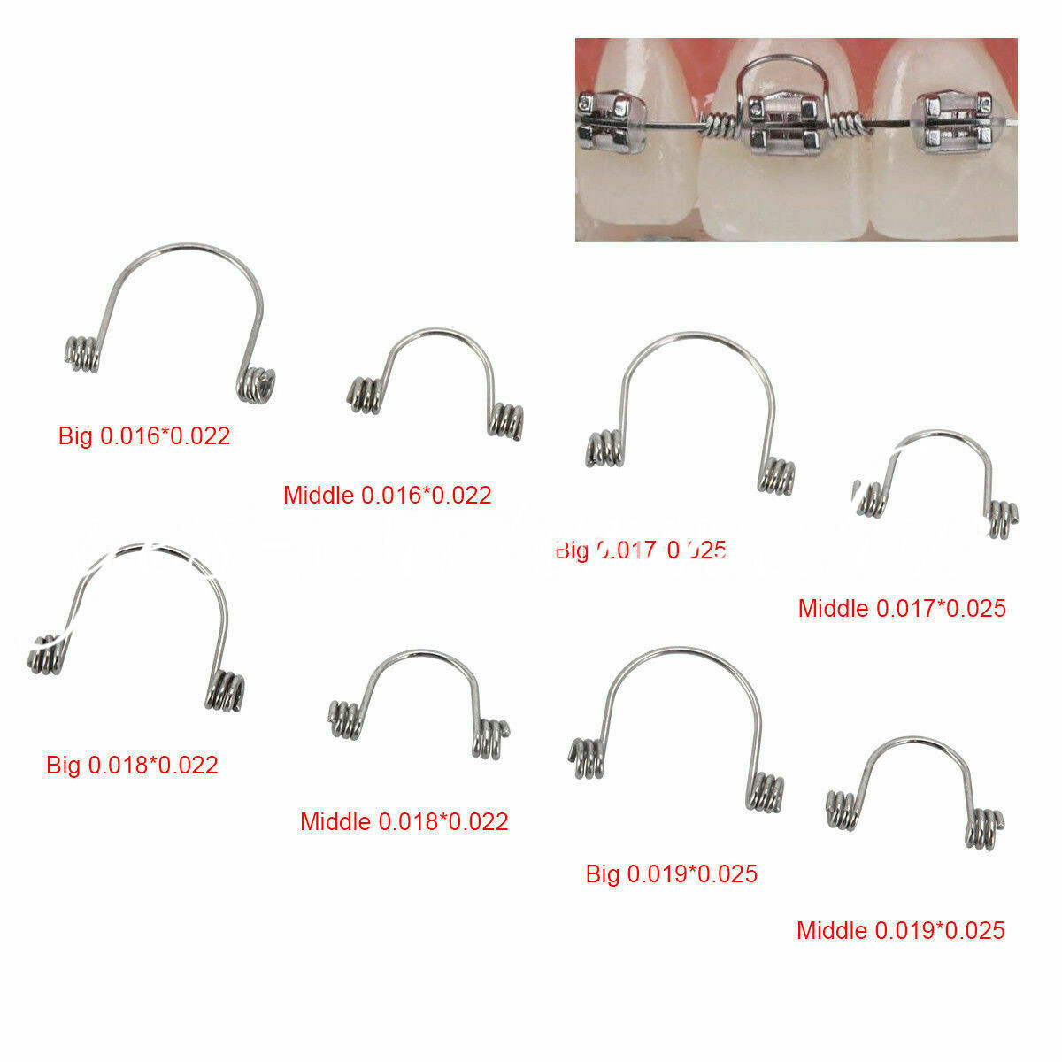 Dental Ortho Anterior Teeth Torque Rectangular Spring 16*22/17*25/18*25/19*25