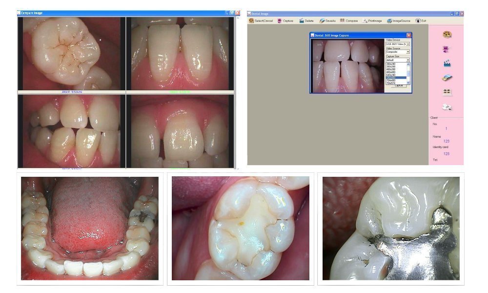 ProDENT Dental Intraoral Camera USB connection PD740 Fast US Ship