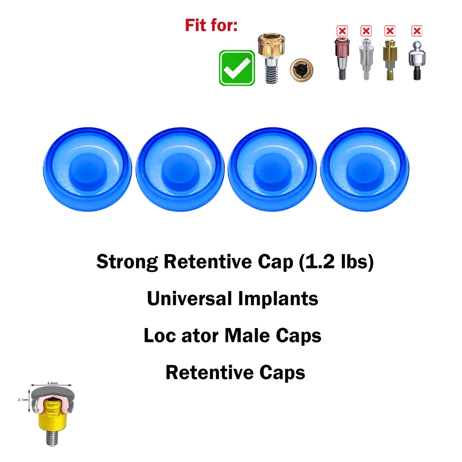 US Dental Overdenture Abutment Removable Male Caps Inserts Standard Blue 1.2 lbs