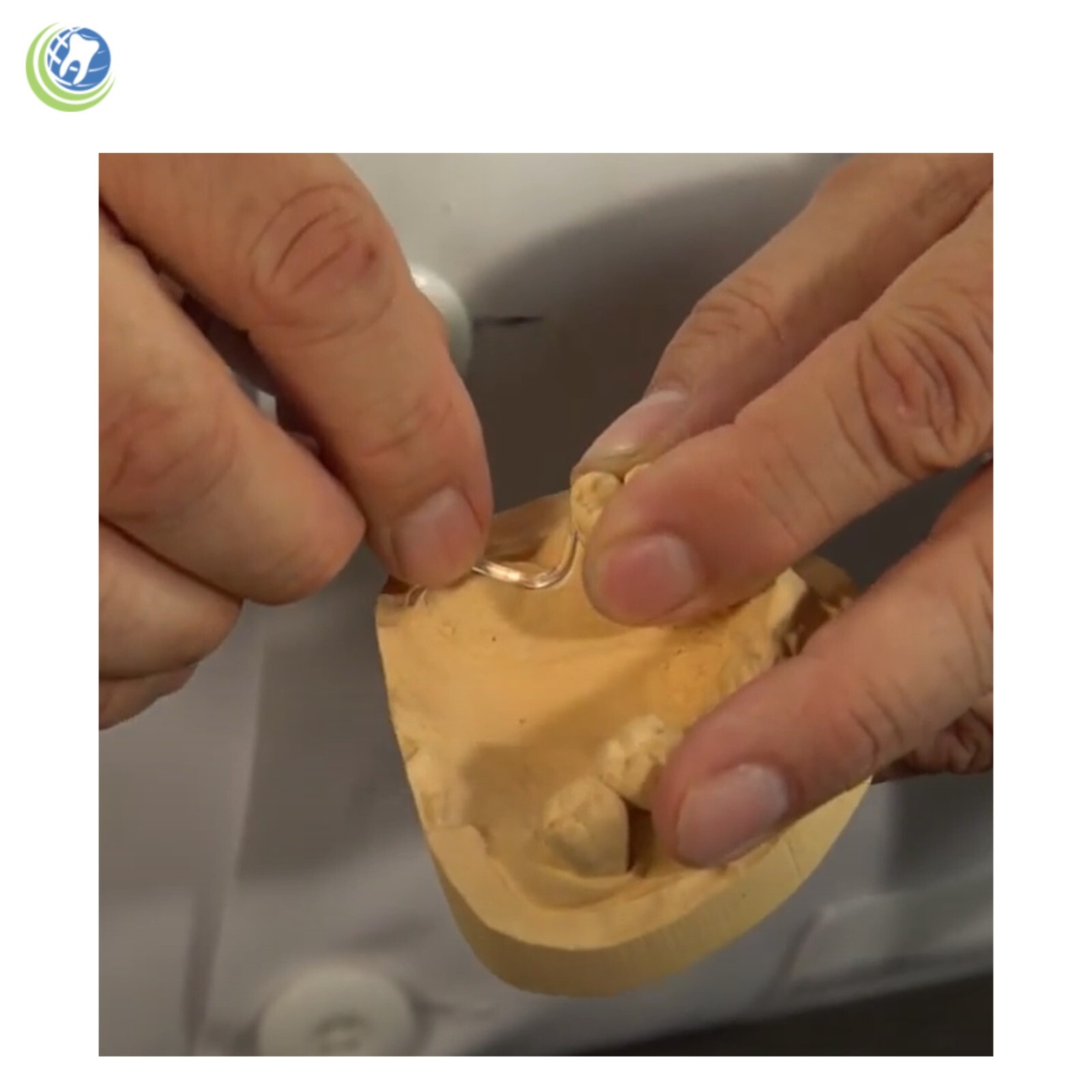 Dental Lab Denture Itsoclear Plastic Claps replace metal acrylic partials Clasps