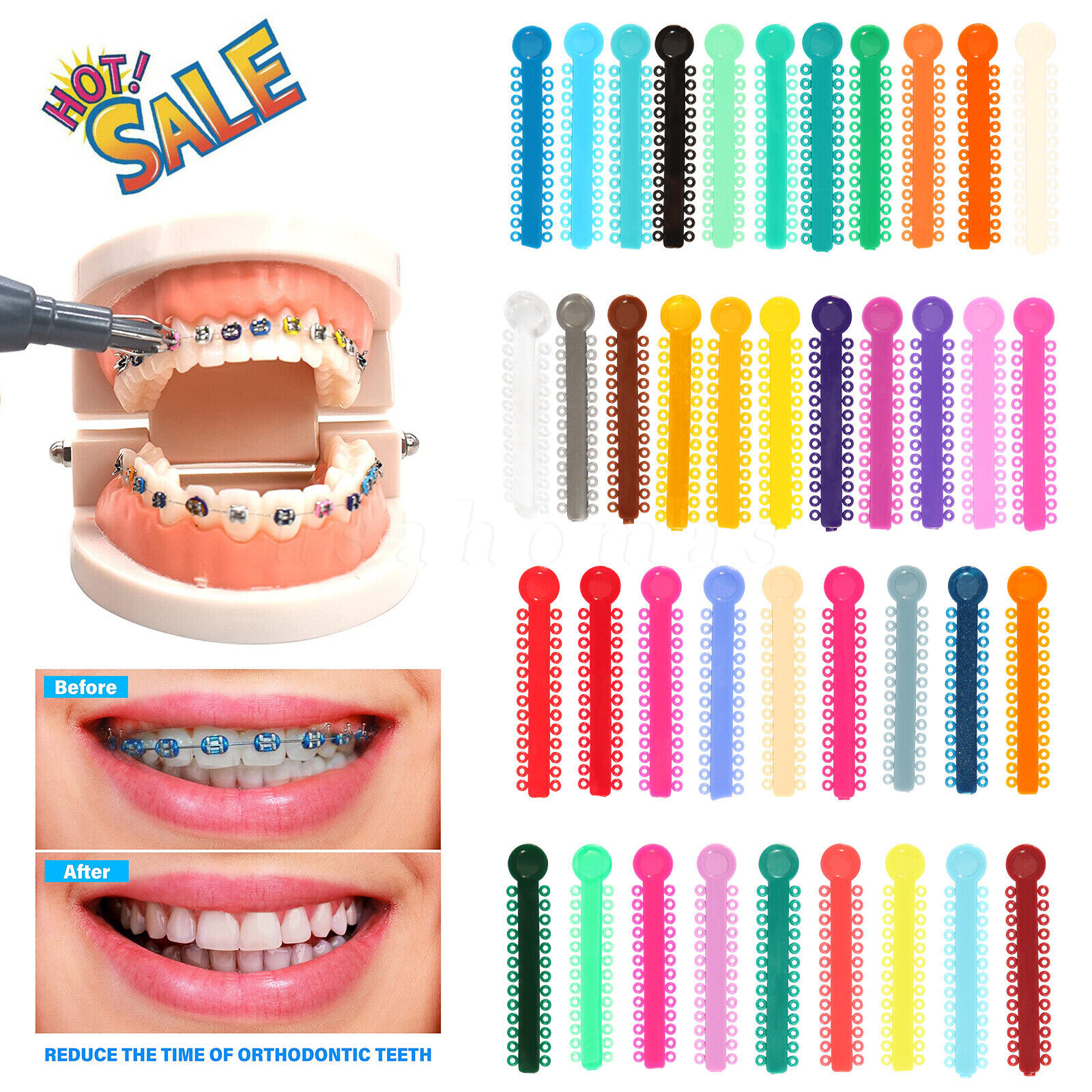1040 piezas Las ligaduras de ortodoncia dental atan bandas de goma elásticas CE