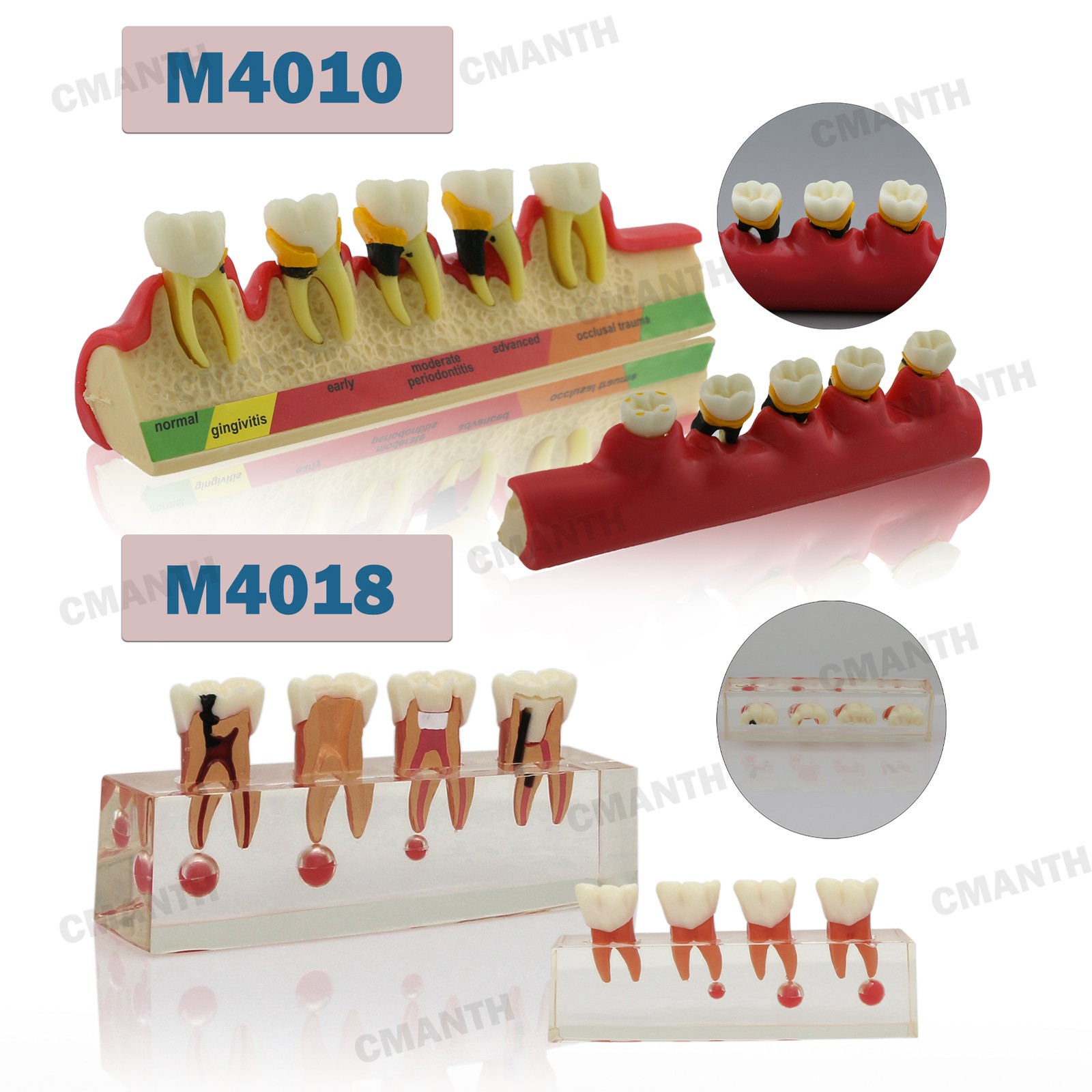 Multiple Types Dental Teeth Model Ortho Implant Pathological Perio Practice Demo