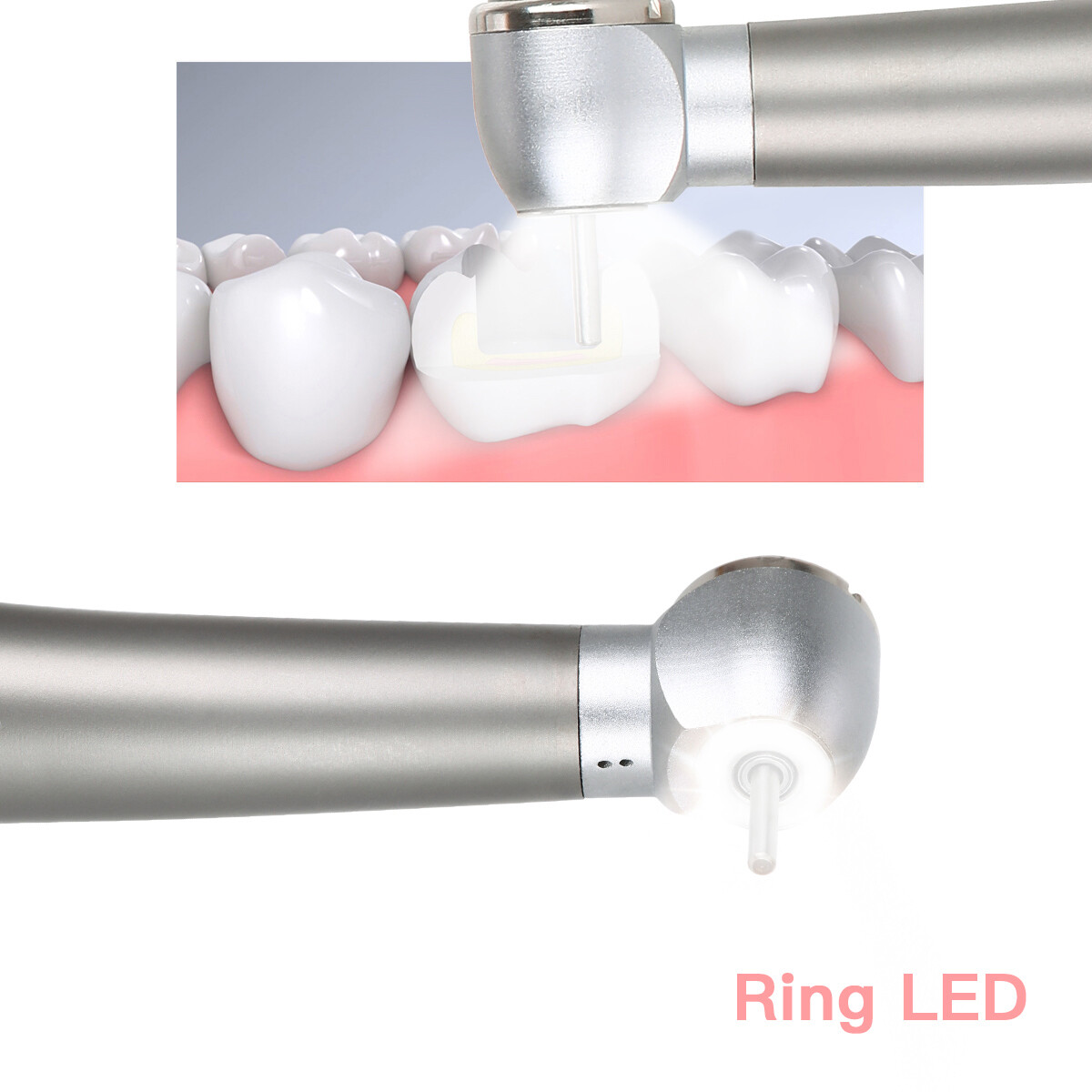 Dental E-generator Shadowless Ring LED High Speed Handpiece 2Hole/4Hole
