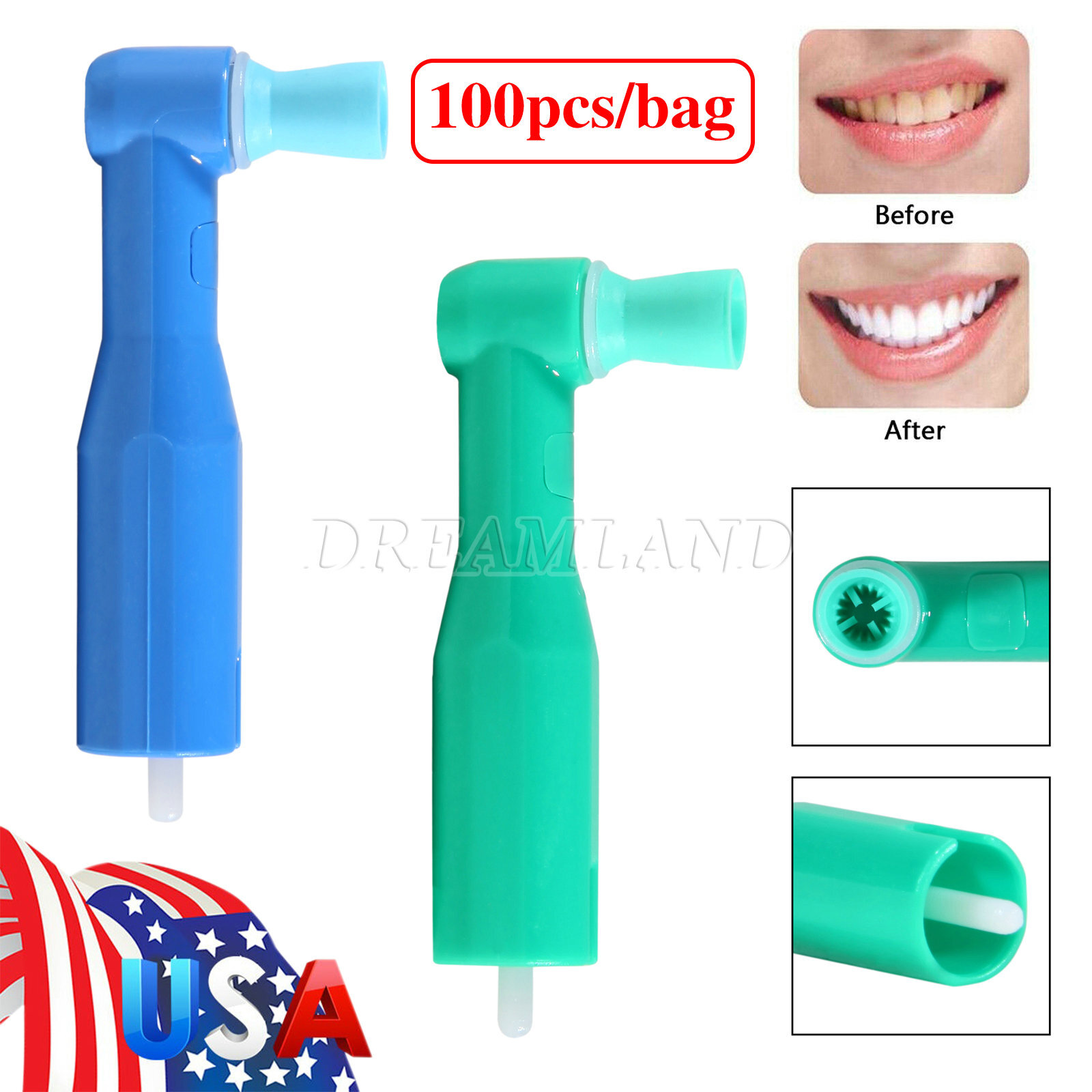 500 pcs Dental Disposable Prophy Angles Top Quality Money back guarantee!