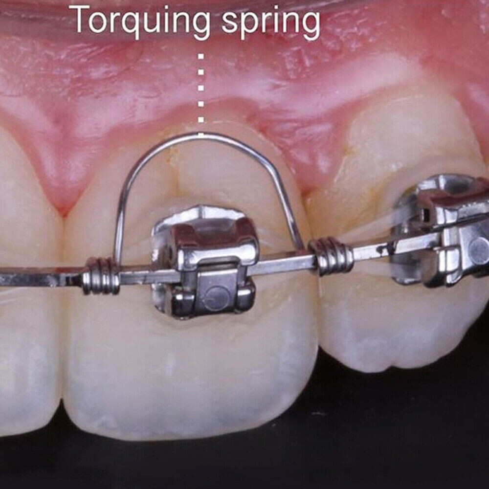 Dental Orthodontic Anterior Teeth Torquing Torque Spring Rectangular Wire Single