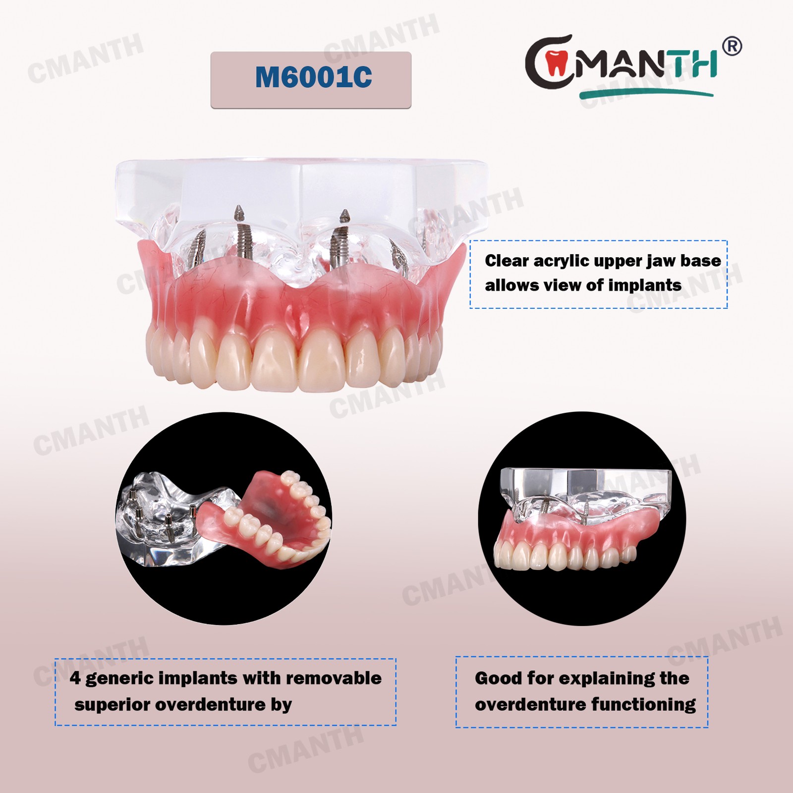 Multiple Types Dental Teeth Model Ortho Implant Pathological Perio Practice Demo