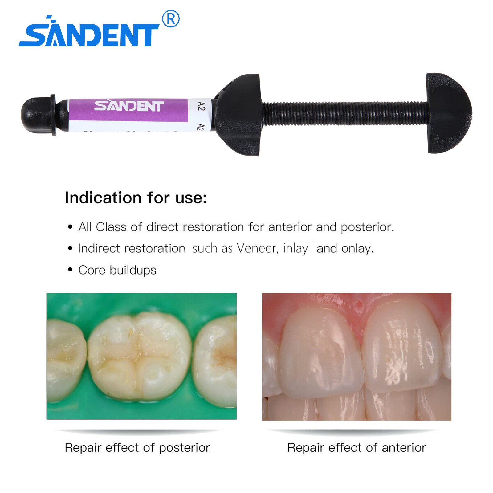 Dental Light Cure Universal Composite Resin Visible Hybrid 4.5 g 001-001 A2/A3