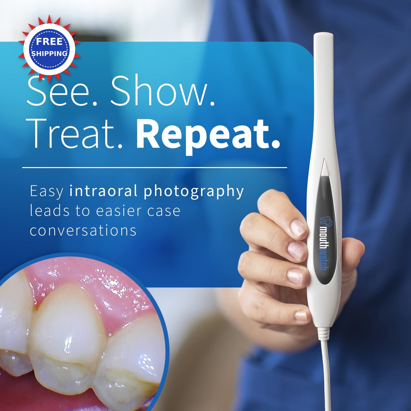 Intraoral Camera MouthWatch Crystal Clear Images Dental Lightweight 31G Easy