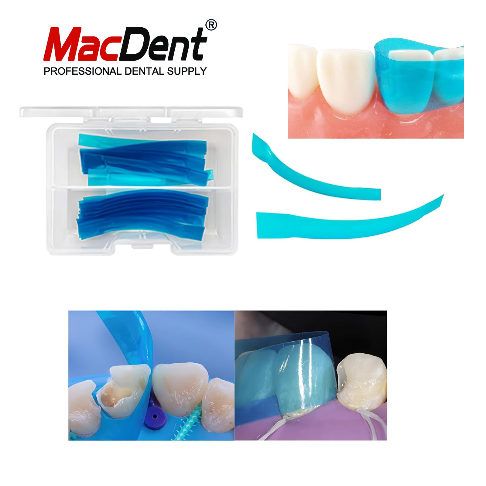 Dental Matrix Bands Ring Sectional Matrice Clamp Fit Garrison Palodent V3 System