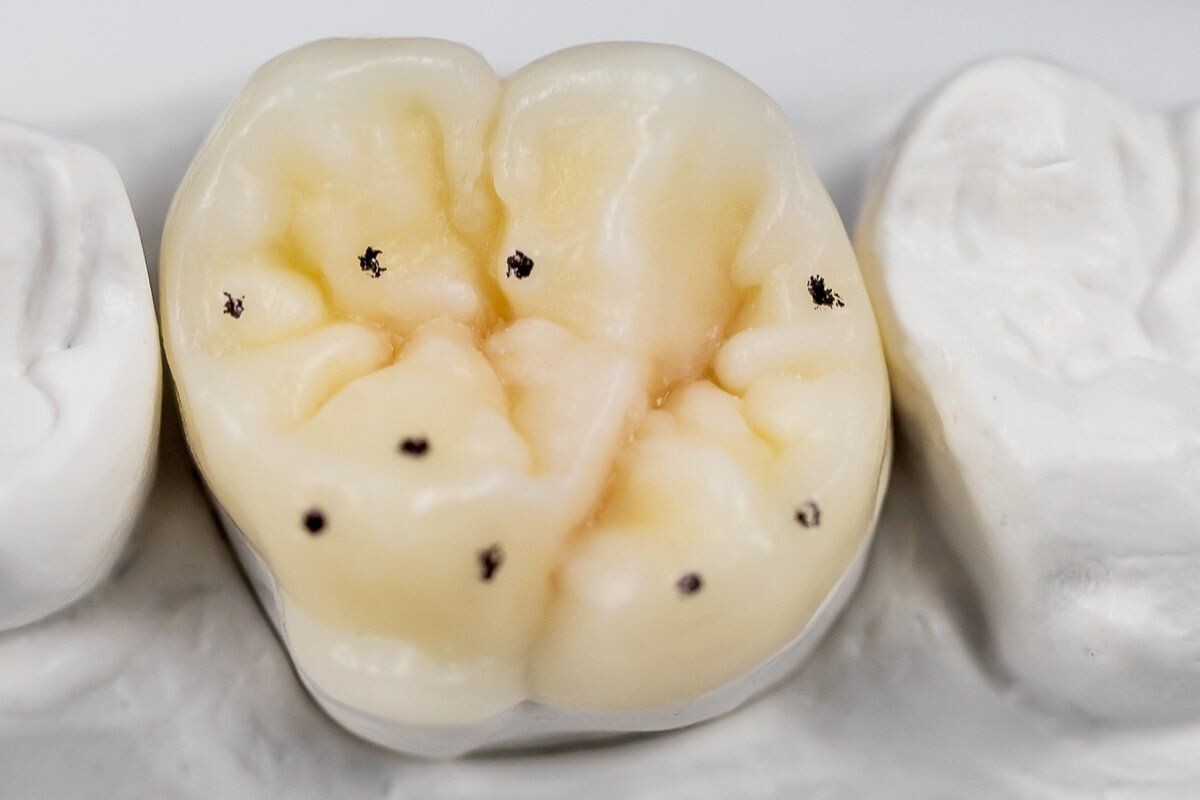 Dental Lab Renfert Geo Expert Functional Wax set modeling crown bridges