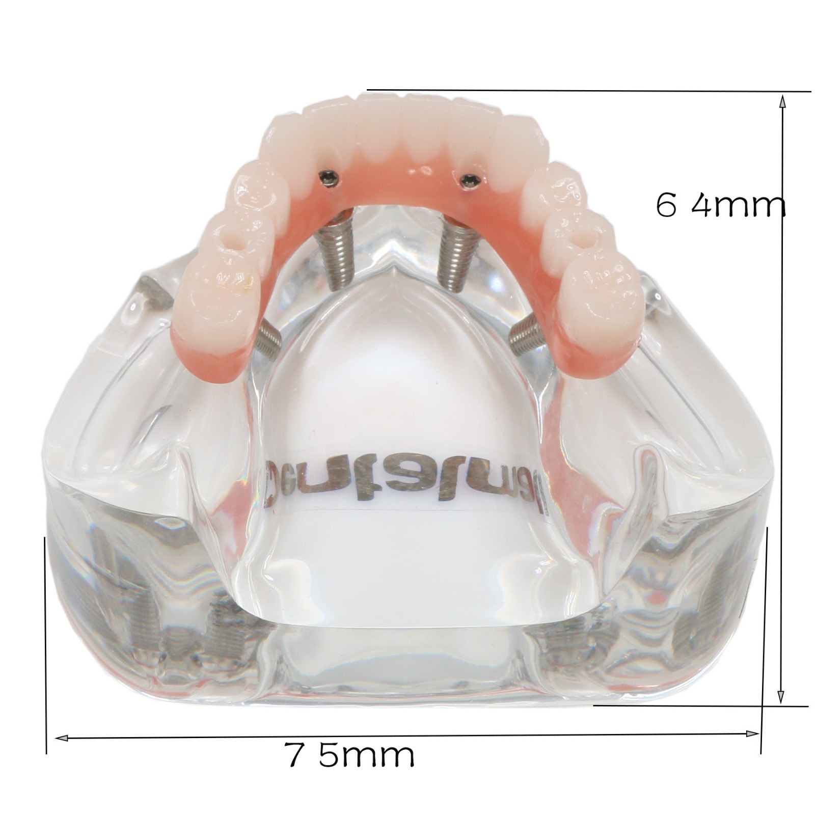 All-On-4 Dental Implant System Overdenture Treatment Teeth Model U/L Jaw W/screw