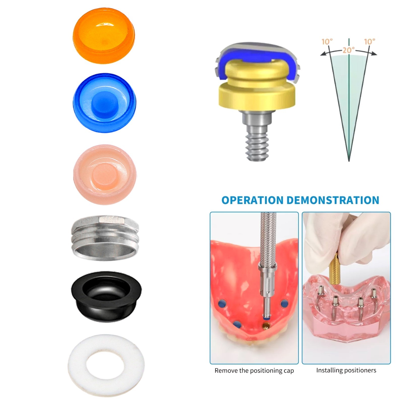 US Dental Overdenture Locator Core Tool Retention Male Caps For Abutment Inserts
