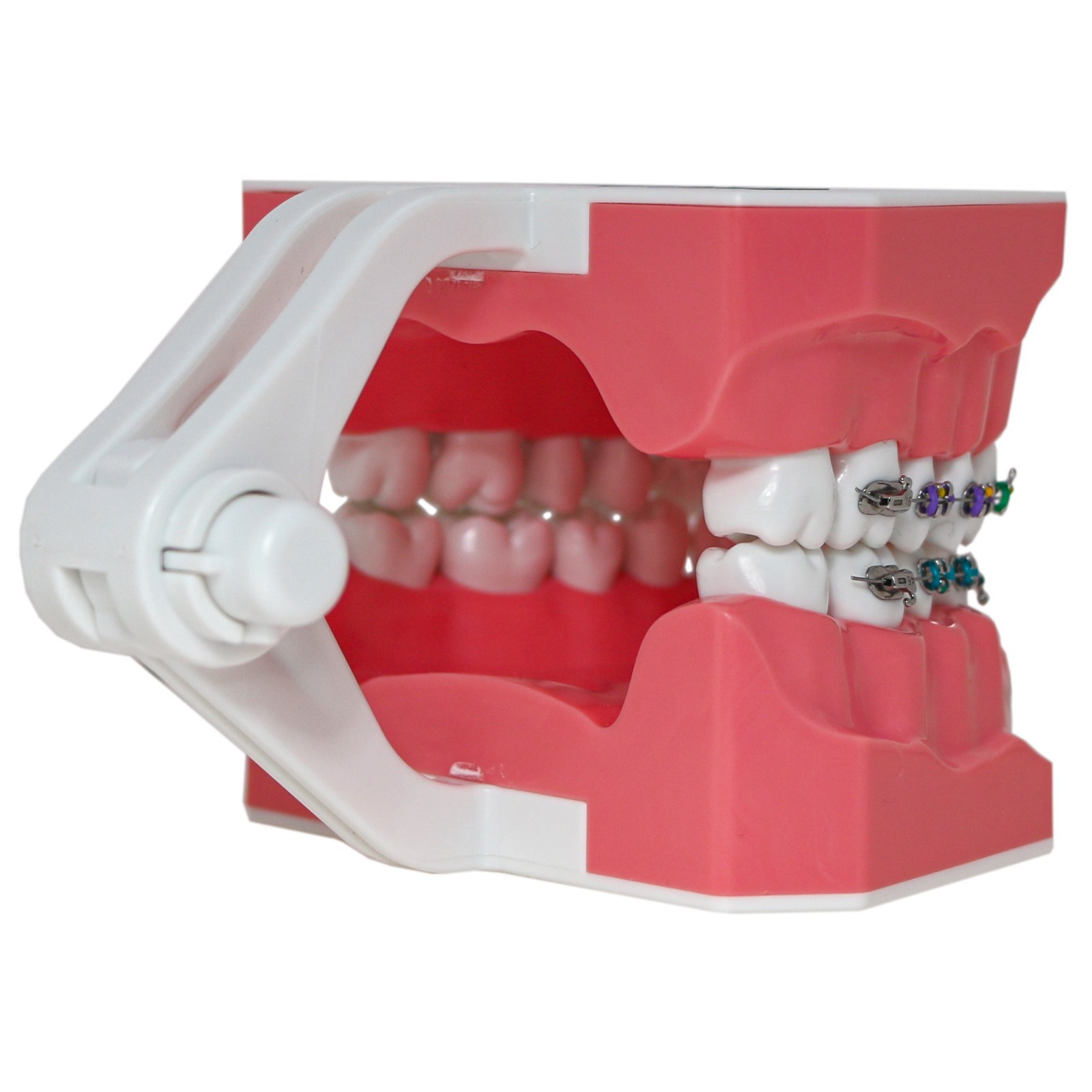 US Dental Typodont Ortho Teeth Model With Metal Braces for Brushing Practice