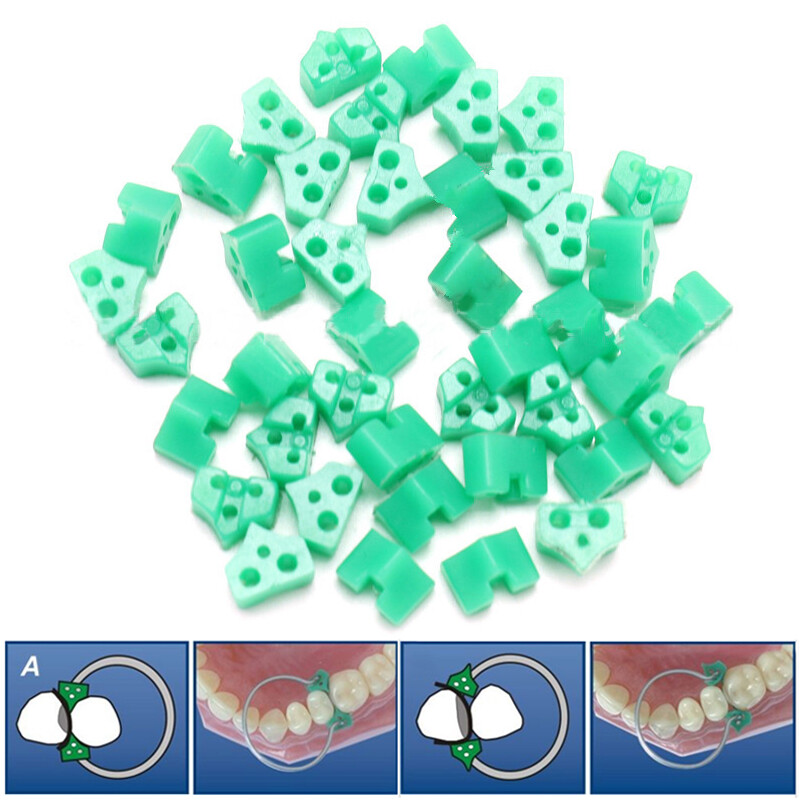 40Pcs Dental Silicone Add-On Wedges Disposable Delta Tine Wedges for Orthodontic