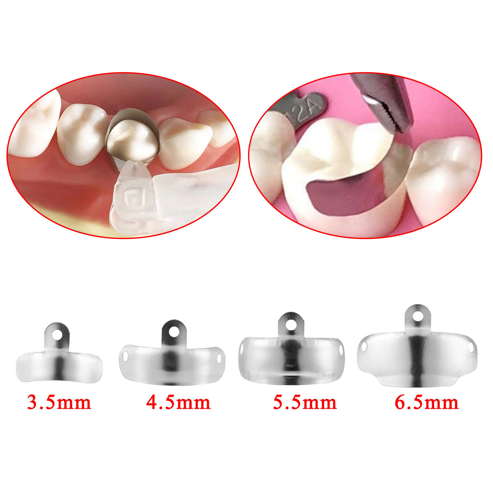 50 Pcs Dental Matrix Bands Palodent V3 Style Sectional Contoured Matrices Refill