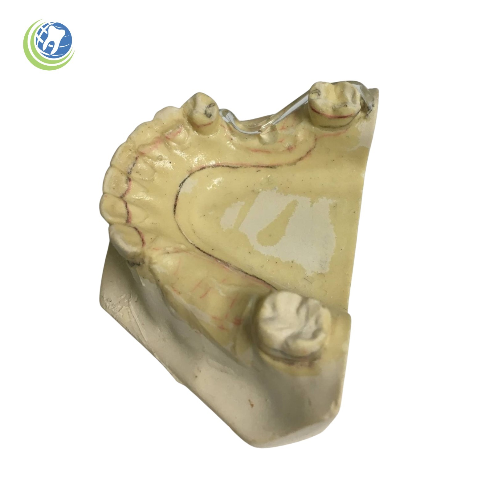 Dental Lab Denture Itsoclear Plastic Claps replace metal acrylic partials Clasps