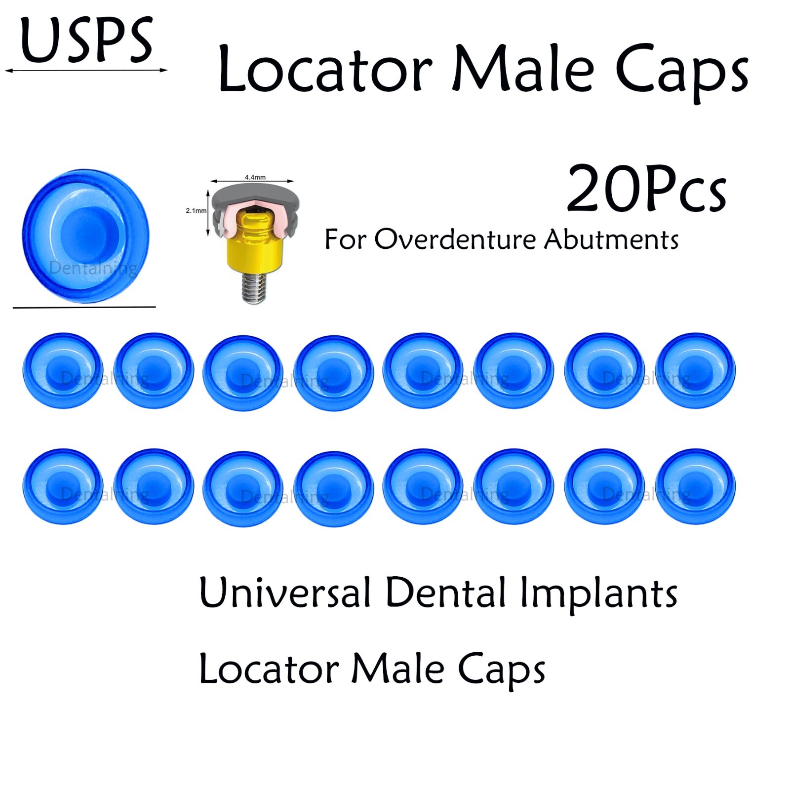 US Dental overdenture Locator Abutment Retention Caps Male Caps Insert Set 20Pcs