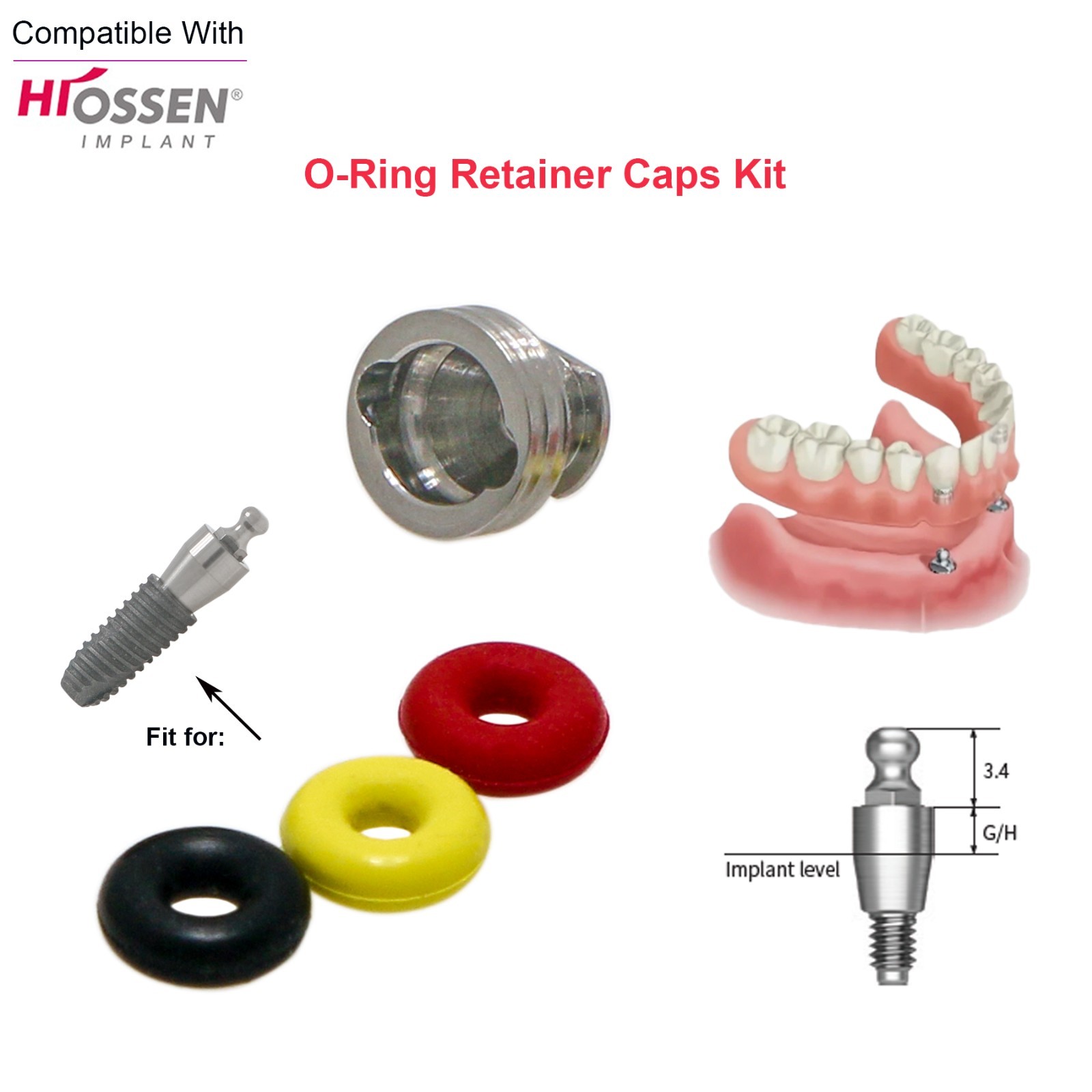US Dental O-ring Retainer Caps Kit For Implant Osstem Ball Attachment Abutments