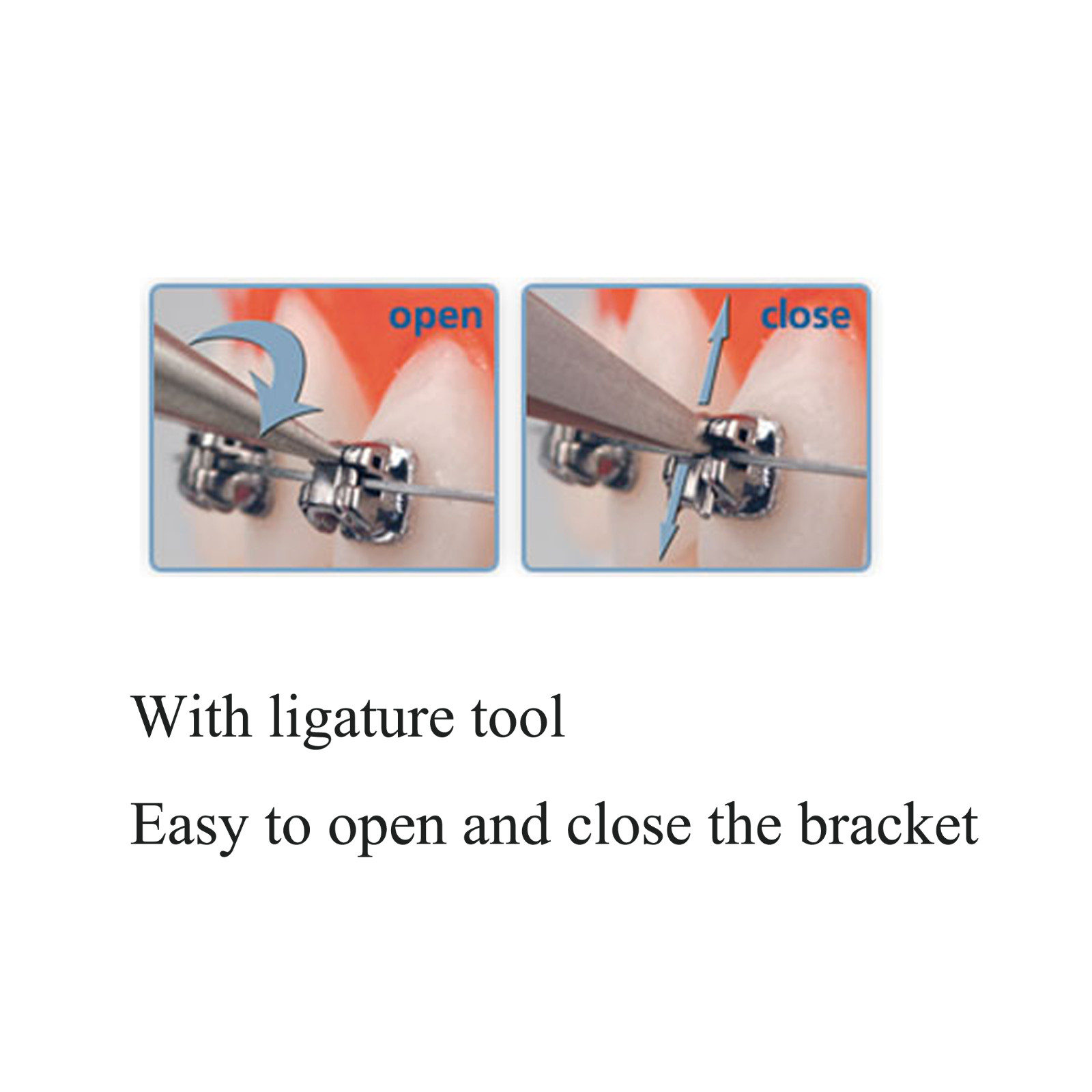 Dental Orthodontic Bracket Metal Braces Mini Standard Roth MBT 022 018 Damon Q
