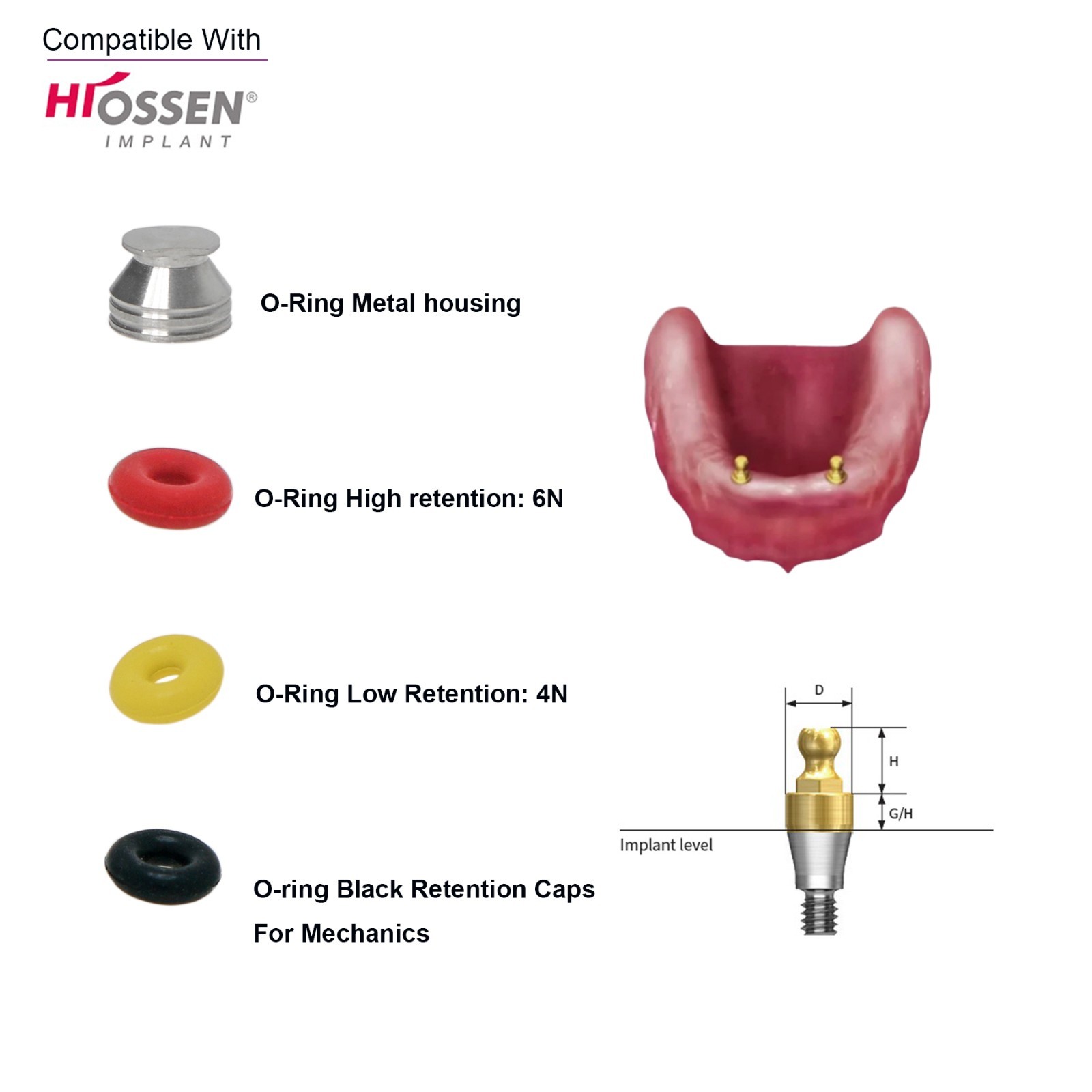US Dental O-ring Retainer Caps Kit For Implant Osstem Ball Attachment Abutments