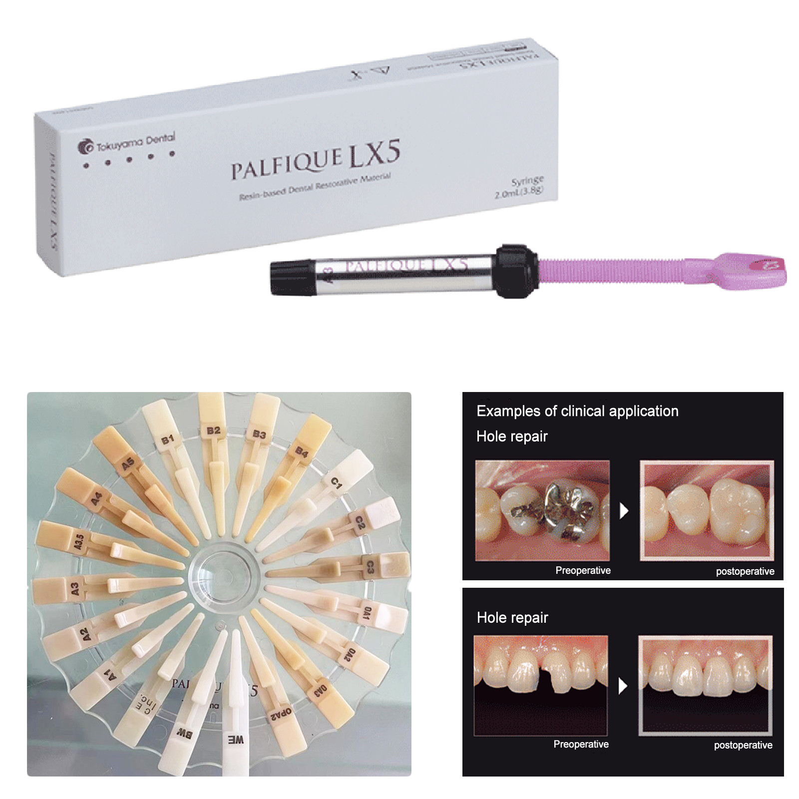 Palfique Tokuyama LX5 Resin Based Dental Restorative Composite 3.8gm All Shades