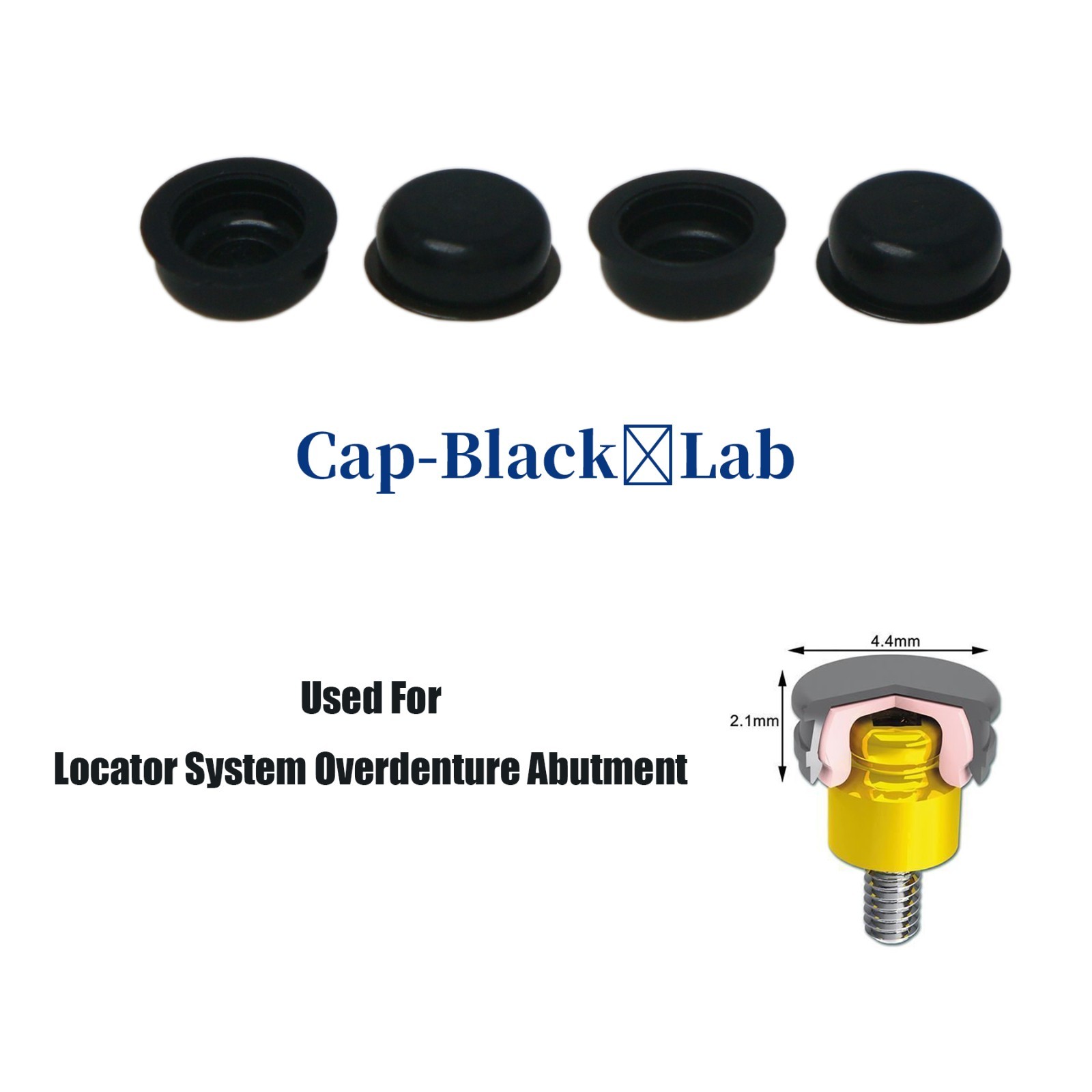 Locator Abutment for Hiossen ET DIO UF/Snucone Regular Overdenture Retention Cap